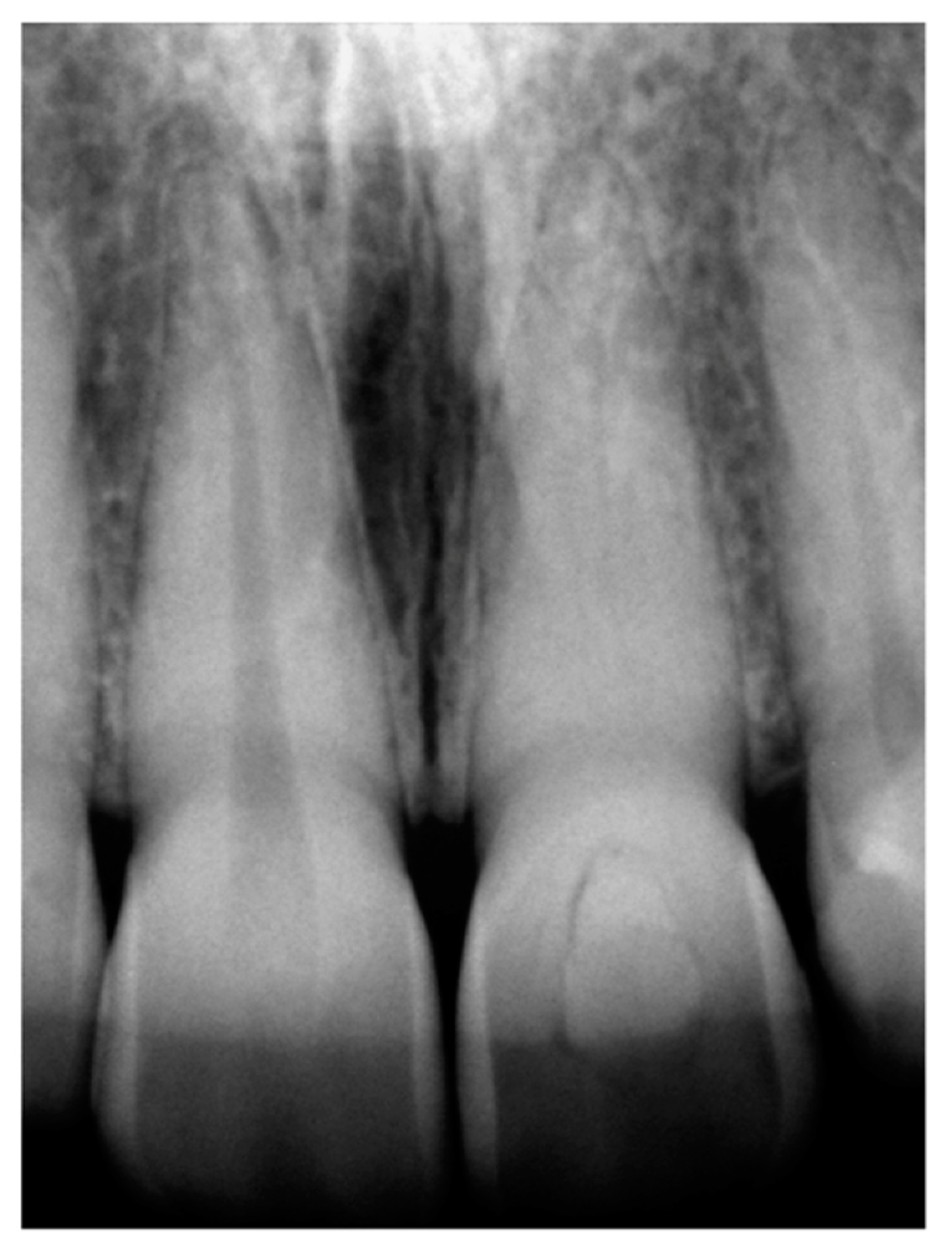 Dentistry 11 00101 g002 Dentistry 11 00101 g002