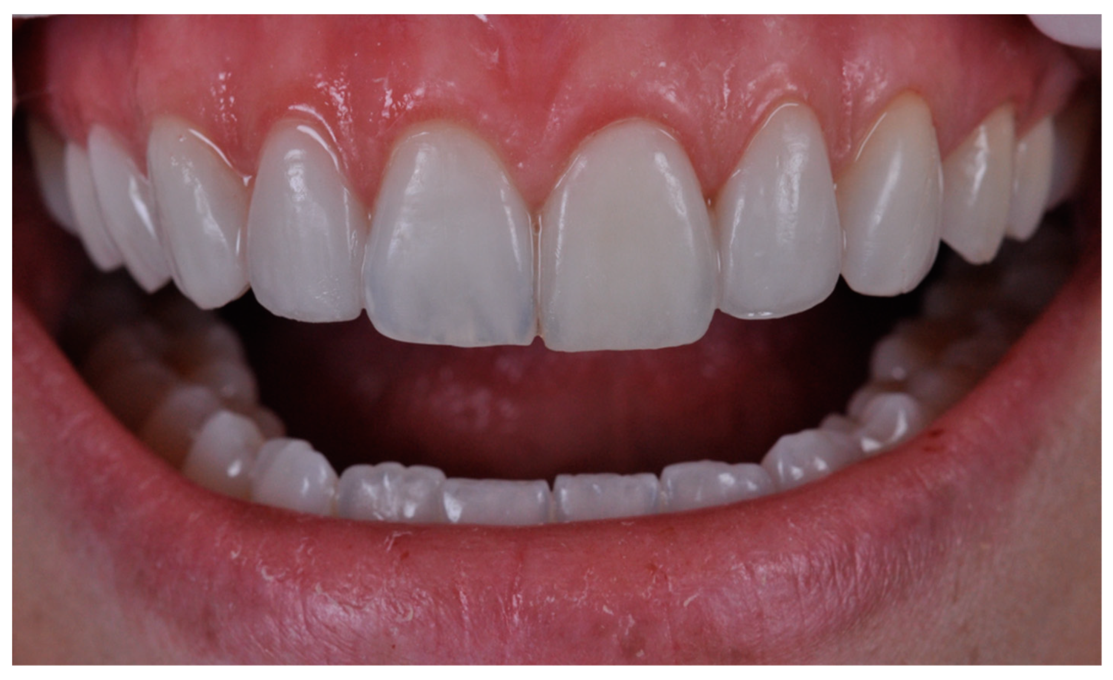 Dentistry 11 00101 g006 Dentistry 11 00101 g006