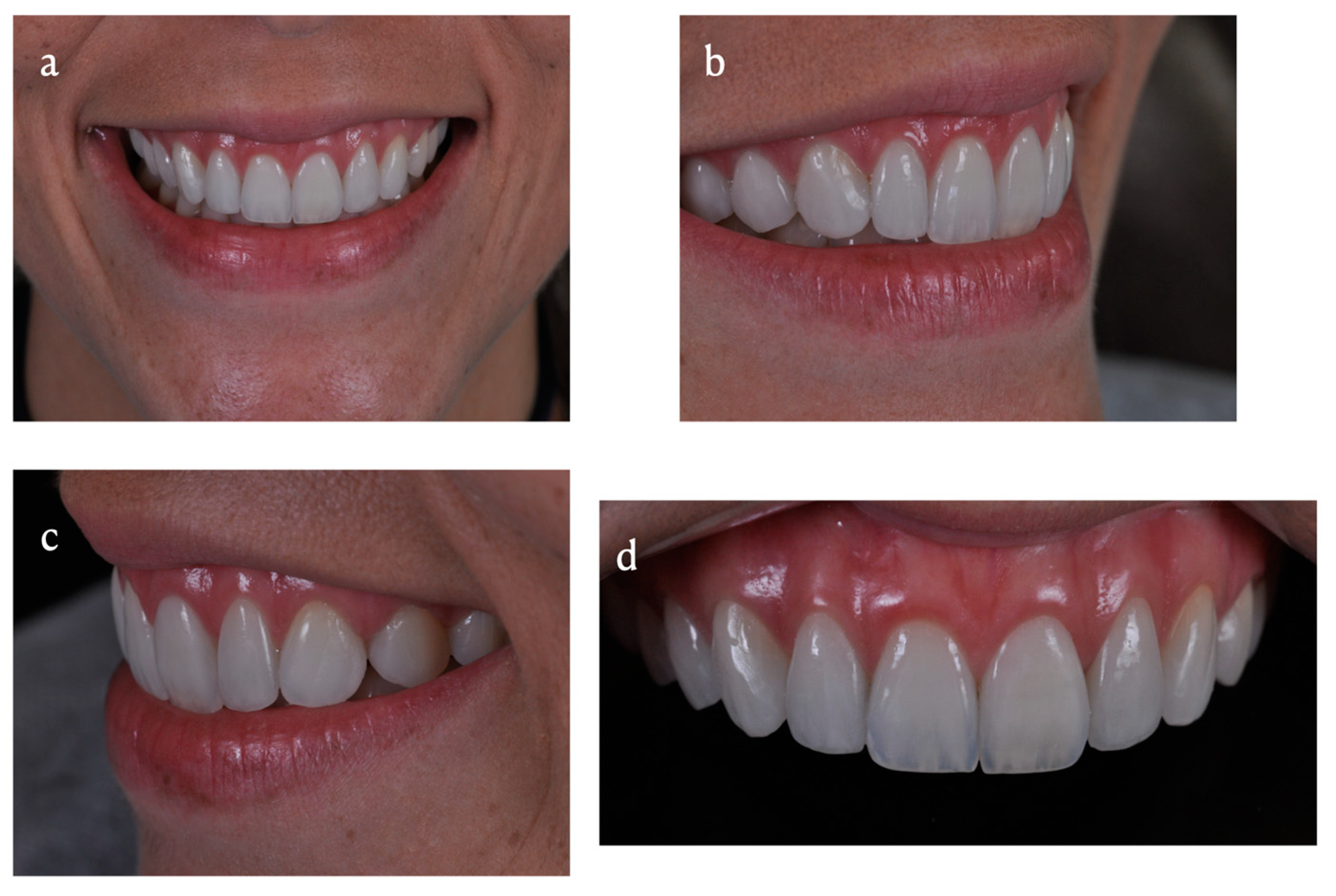 Dentistry 11 00101 g007 Dentistry 11 00101 g007