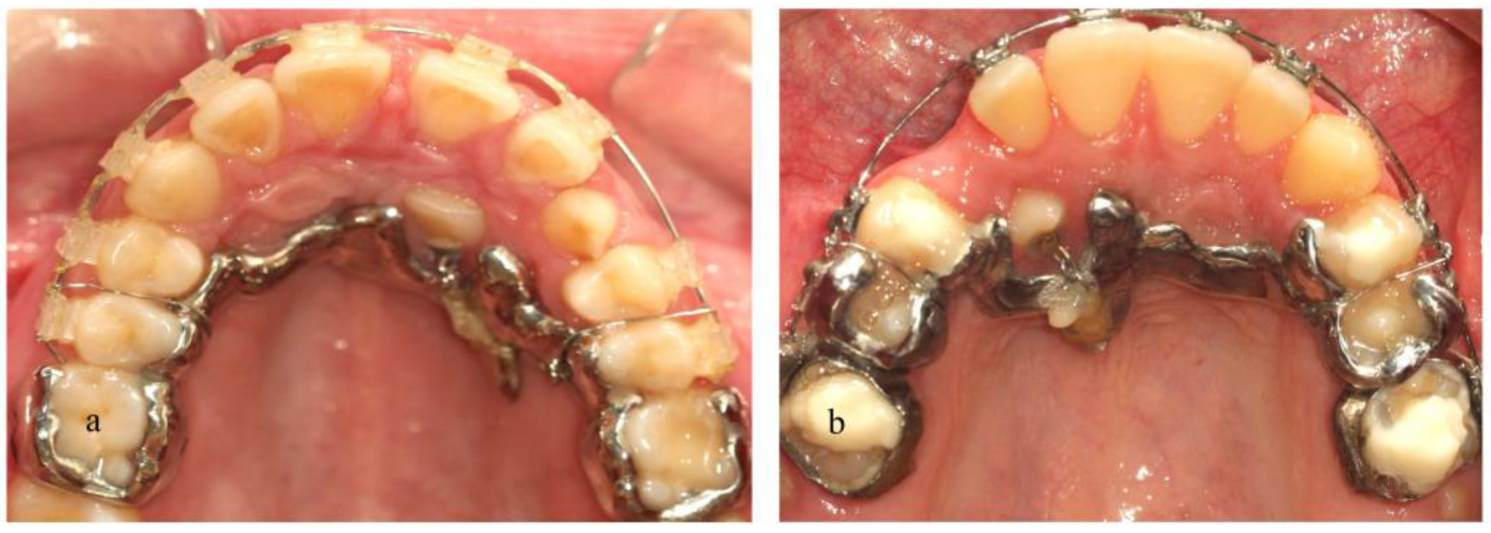 Dentistry 11 00102 g008