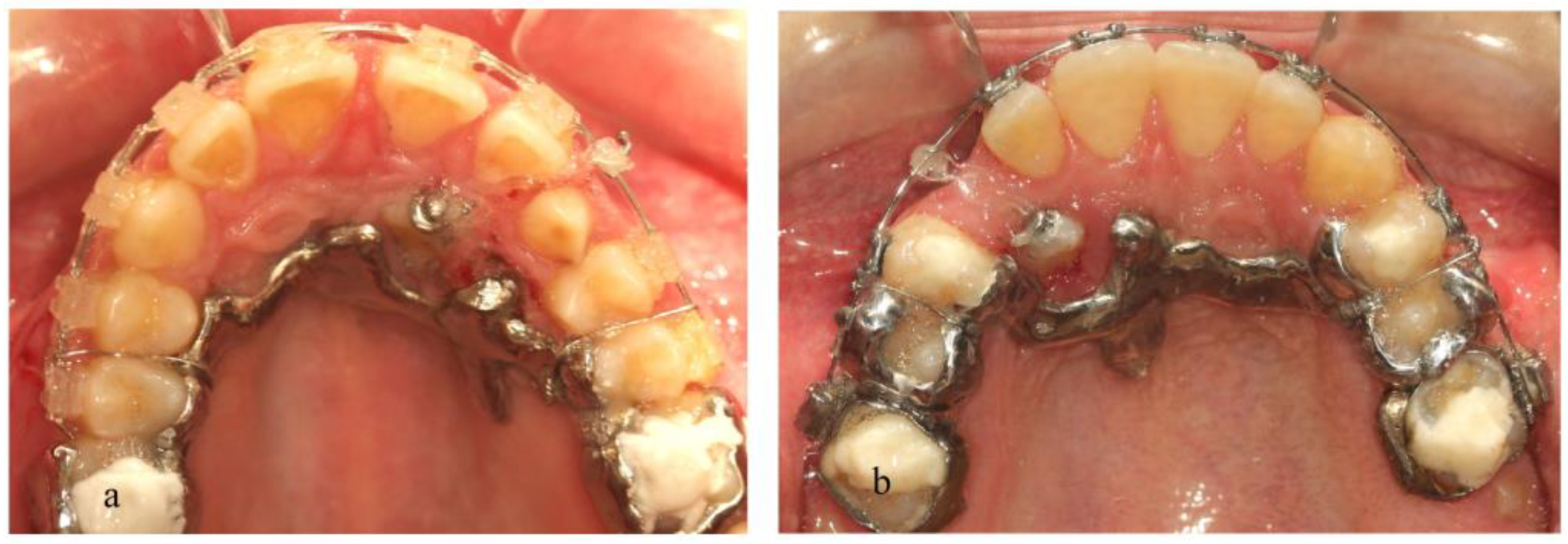 Dentistry 11 00102 g009