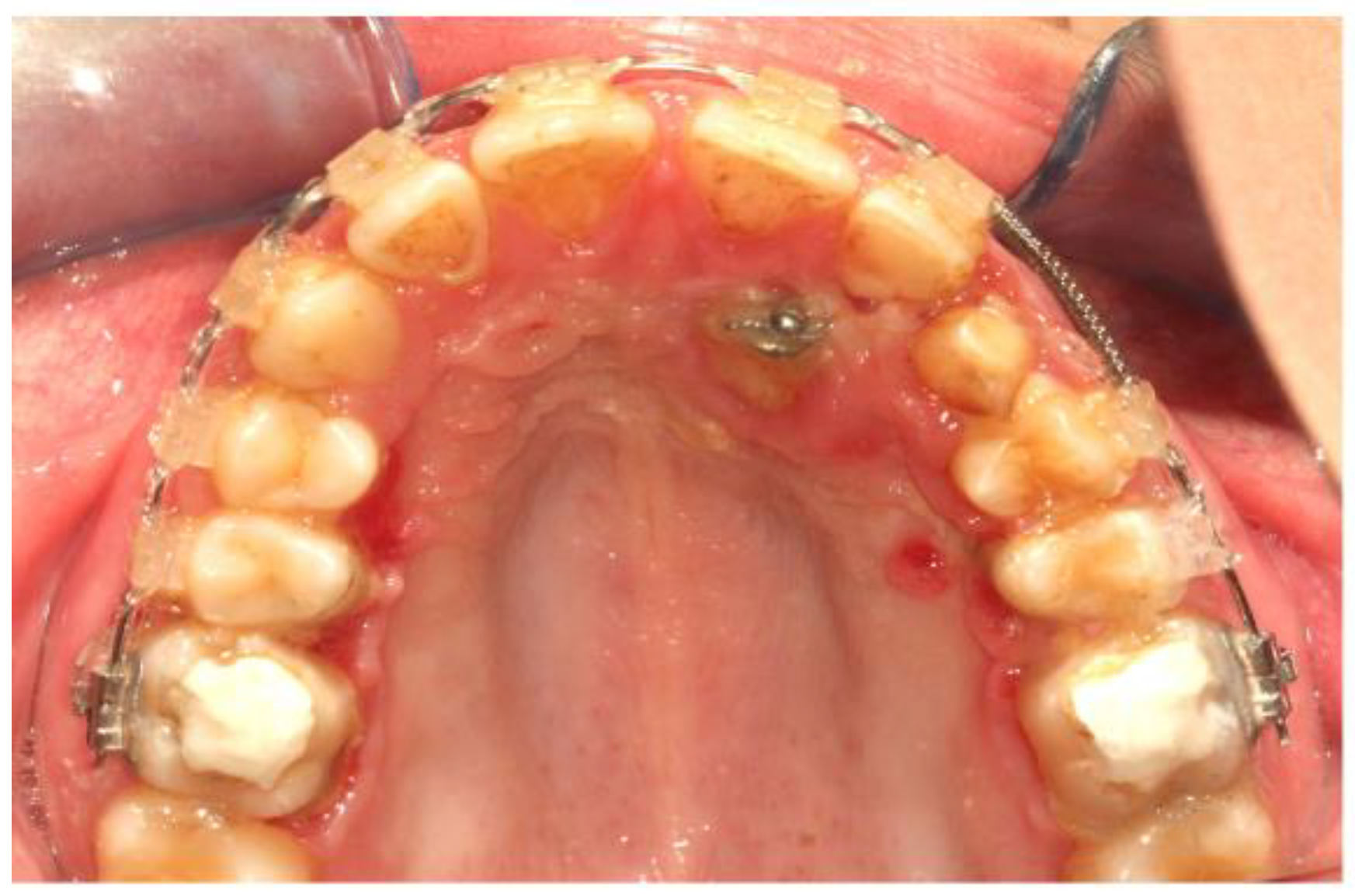 Dentistry 11 00102 g010