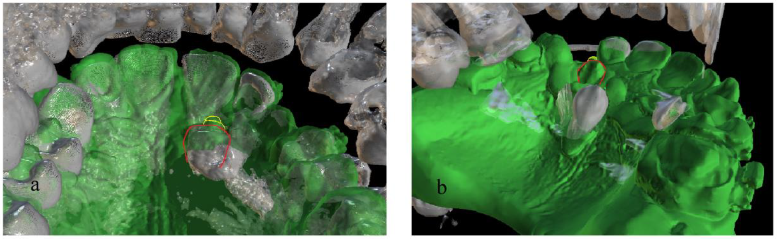 Dentistry 11 00102 g011