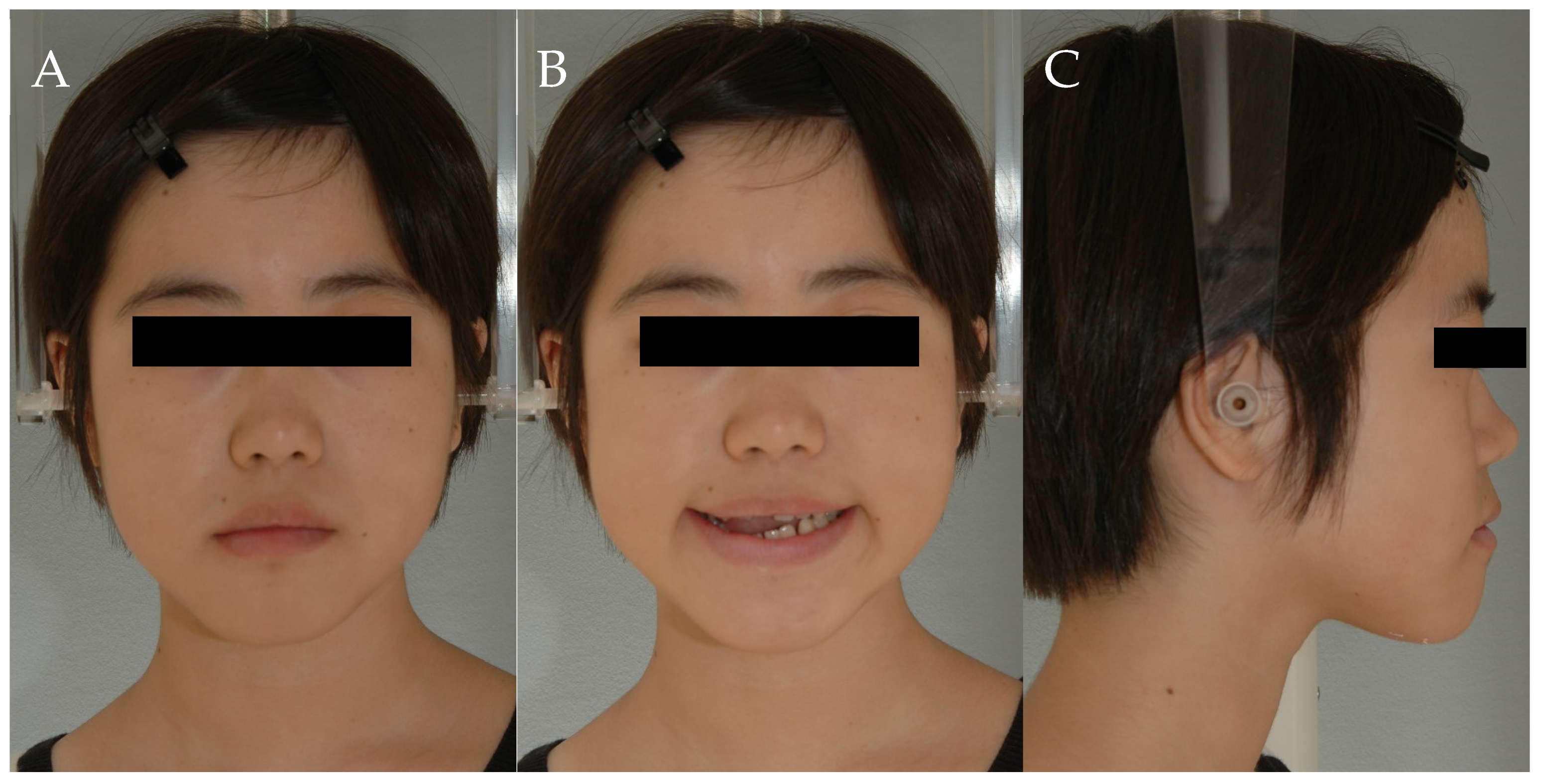 Dentistry 11 00107 g001 Dentistry 11 00107 g001