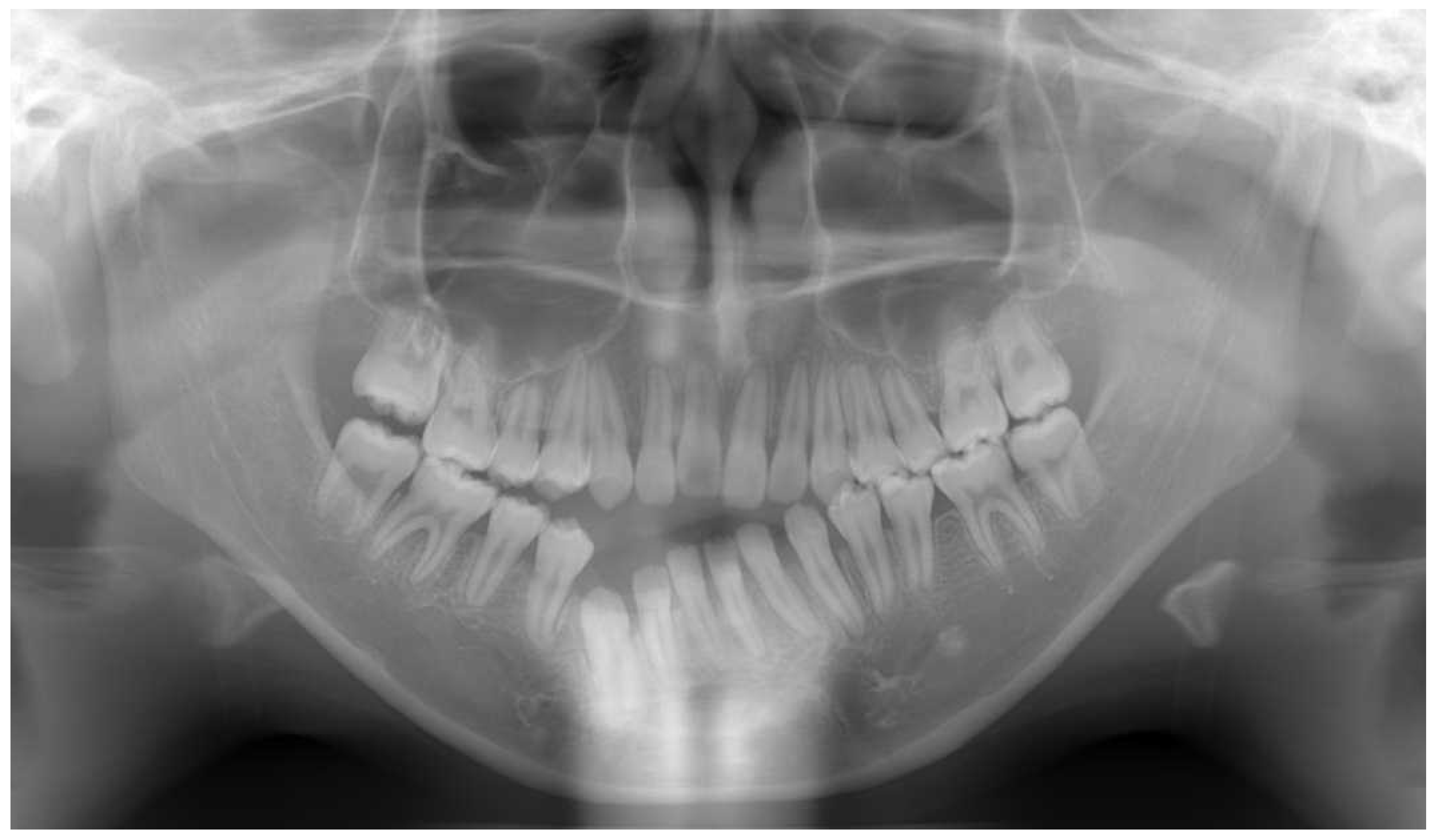 Dentistry 11 00107 g003 Dentistry 11 00107 g003