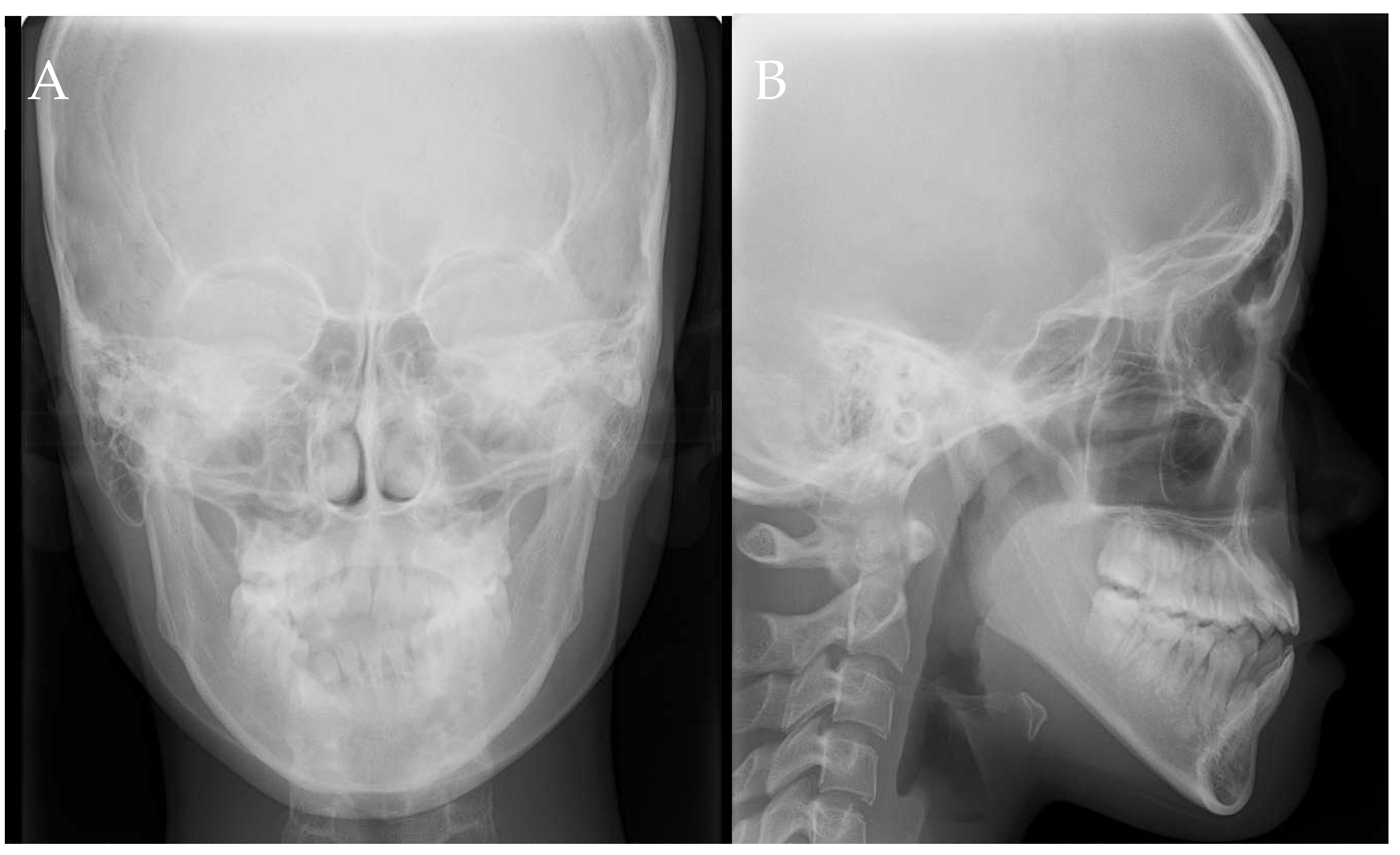 Dentistry 11 00107 g004 Dentistry 11 00107 g004