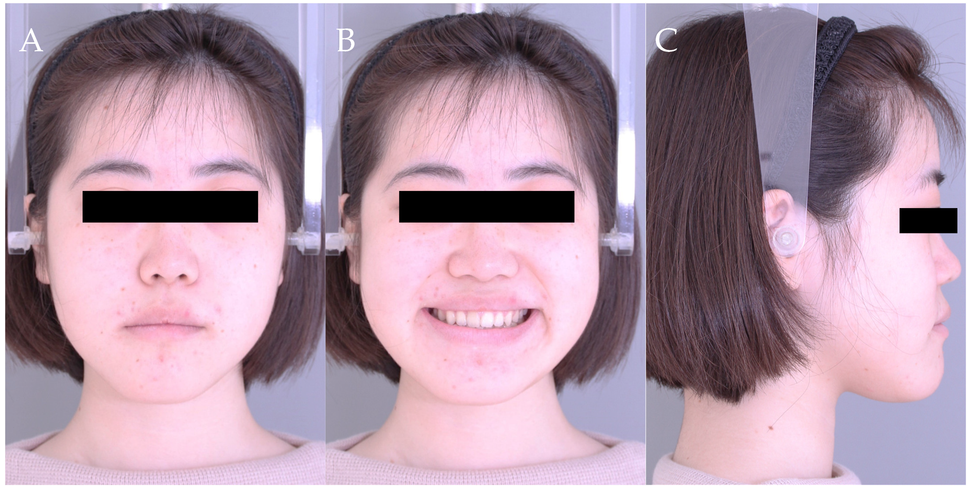 Dentistry 11 00107 g008 Dentistry 11 00107 g008