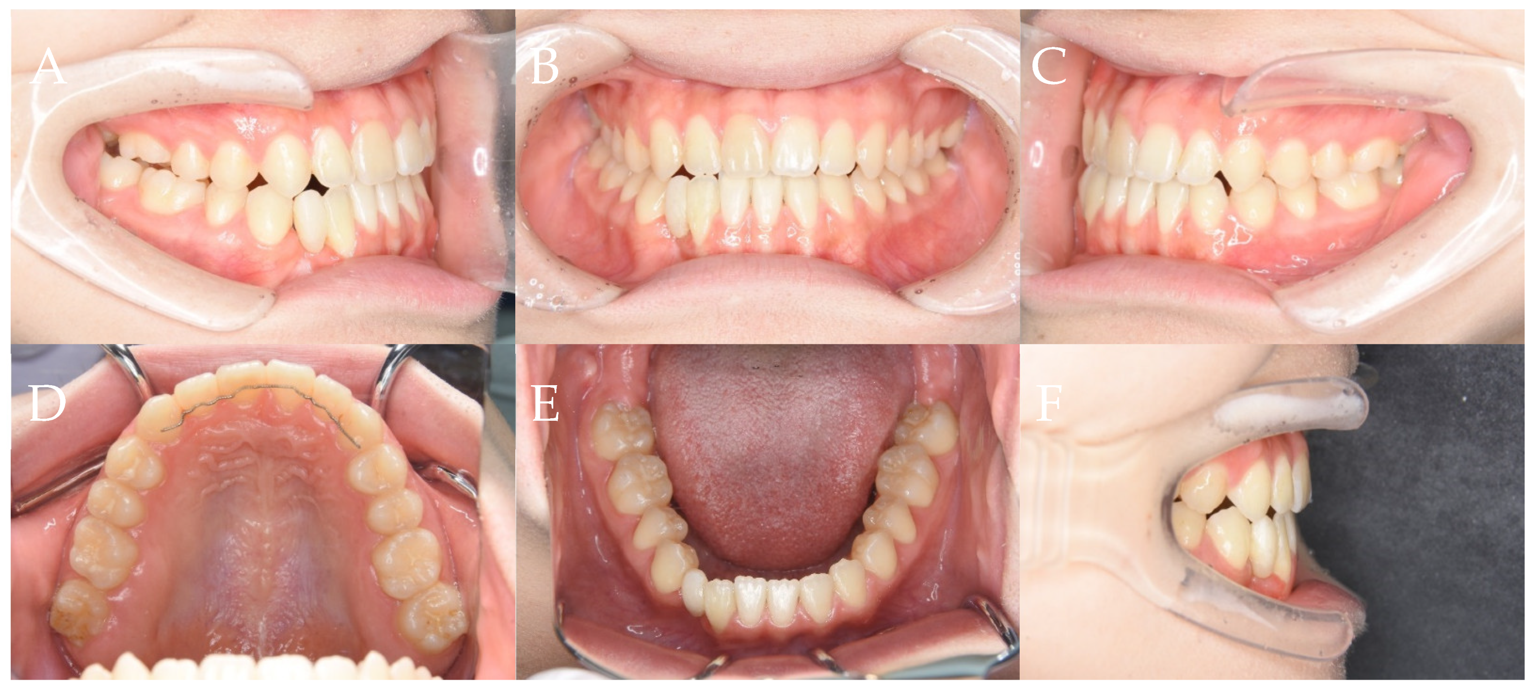 Dentistry 11 00107 g009 Dentistry 11 00107 g009