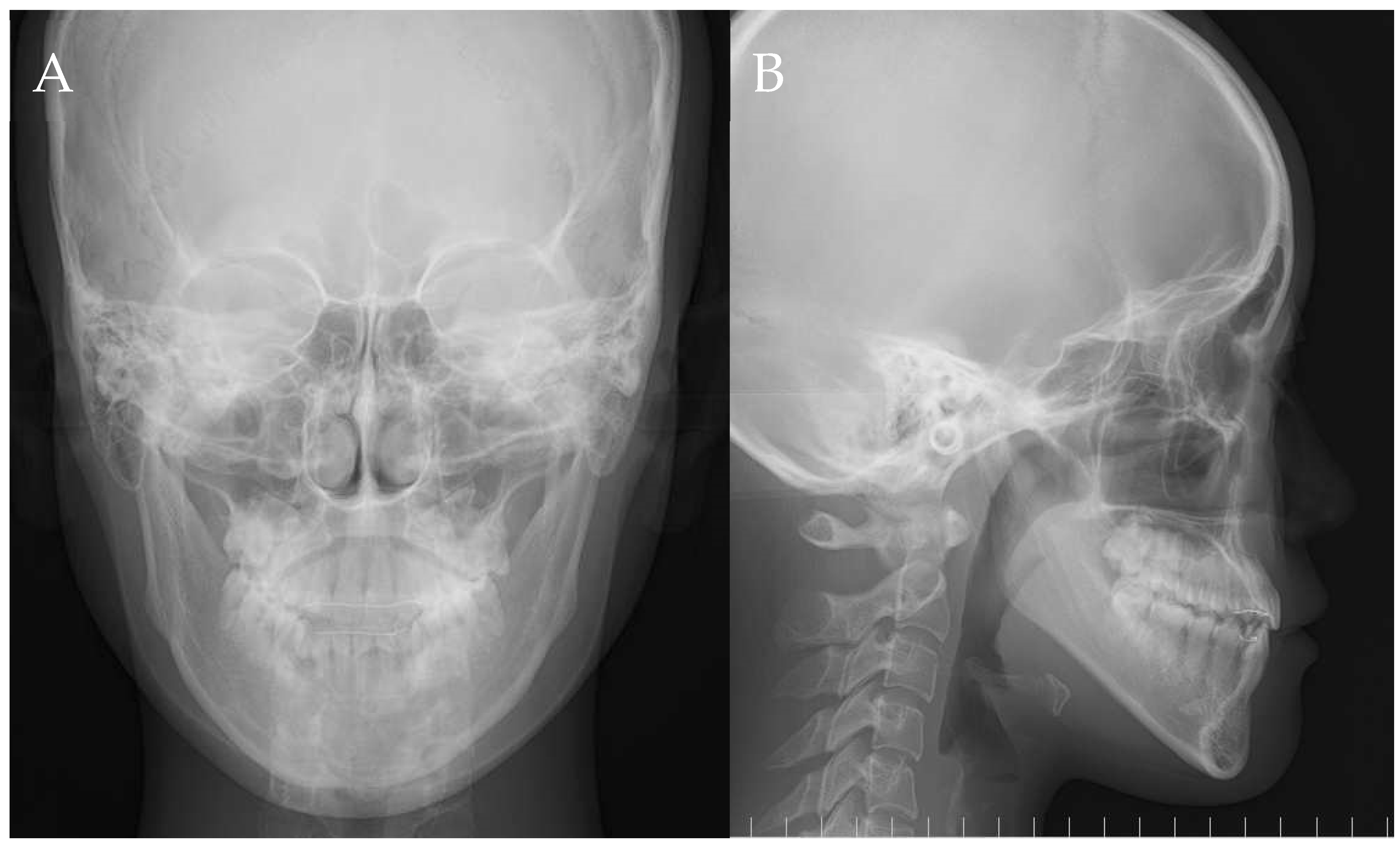 Dentistry 11 00107 g011 Dentistry 11 00107 g011