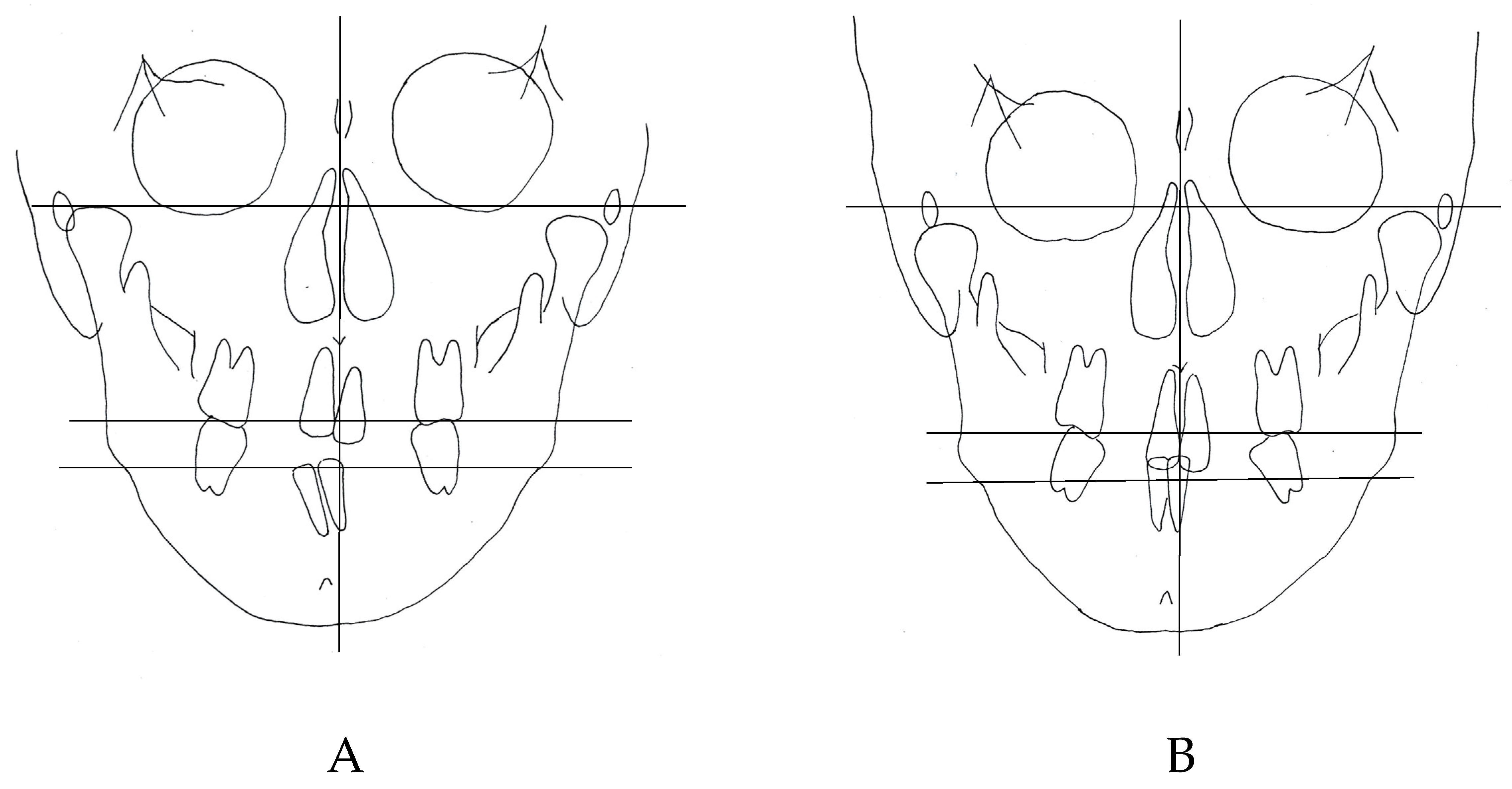 Dentistry 11 00107 g012 Dentistry 11 00107 g012