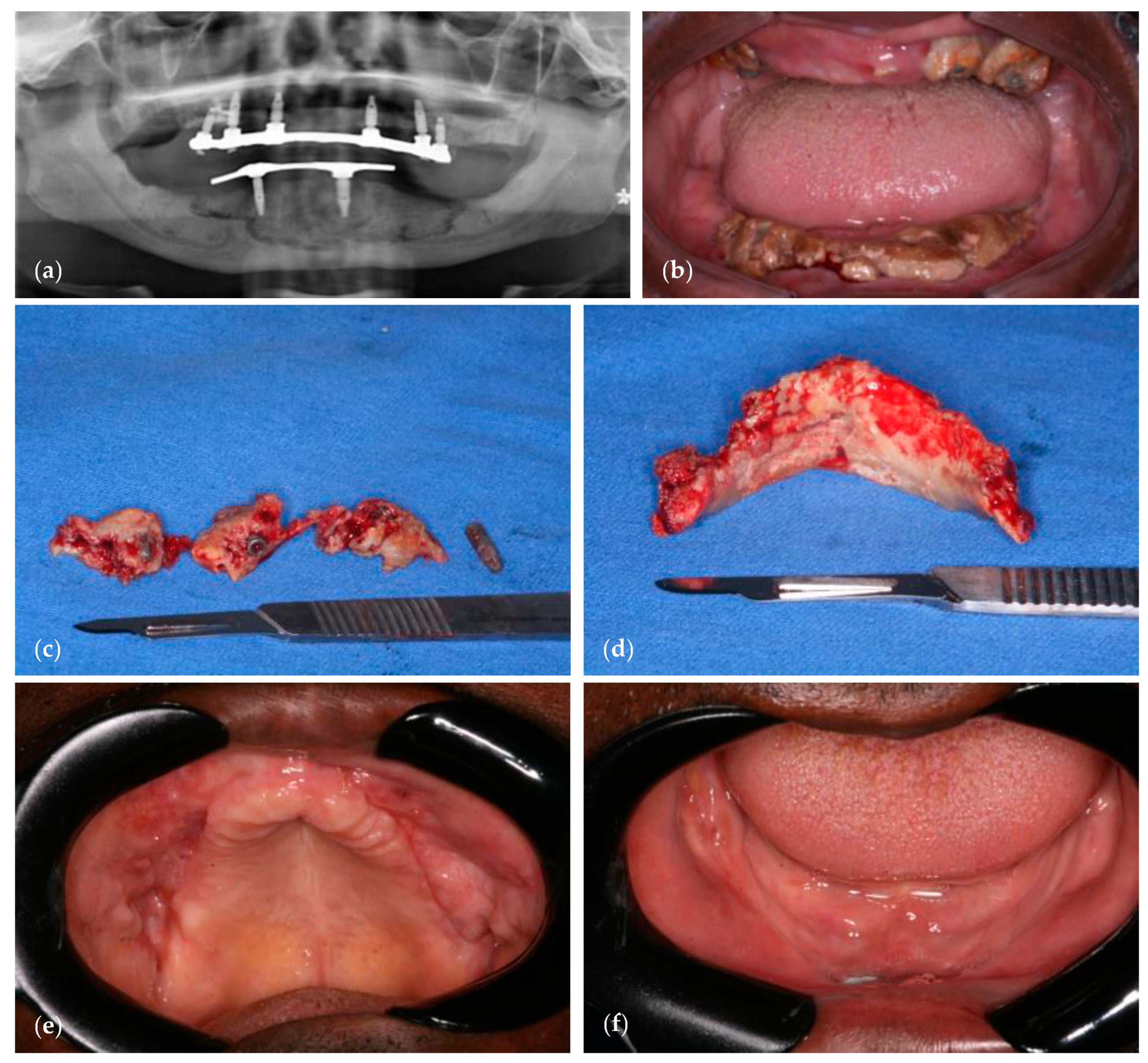 Dentistry 11 00109 g002