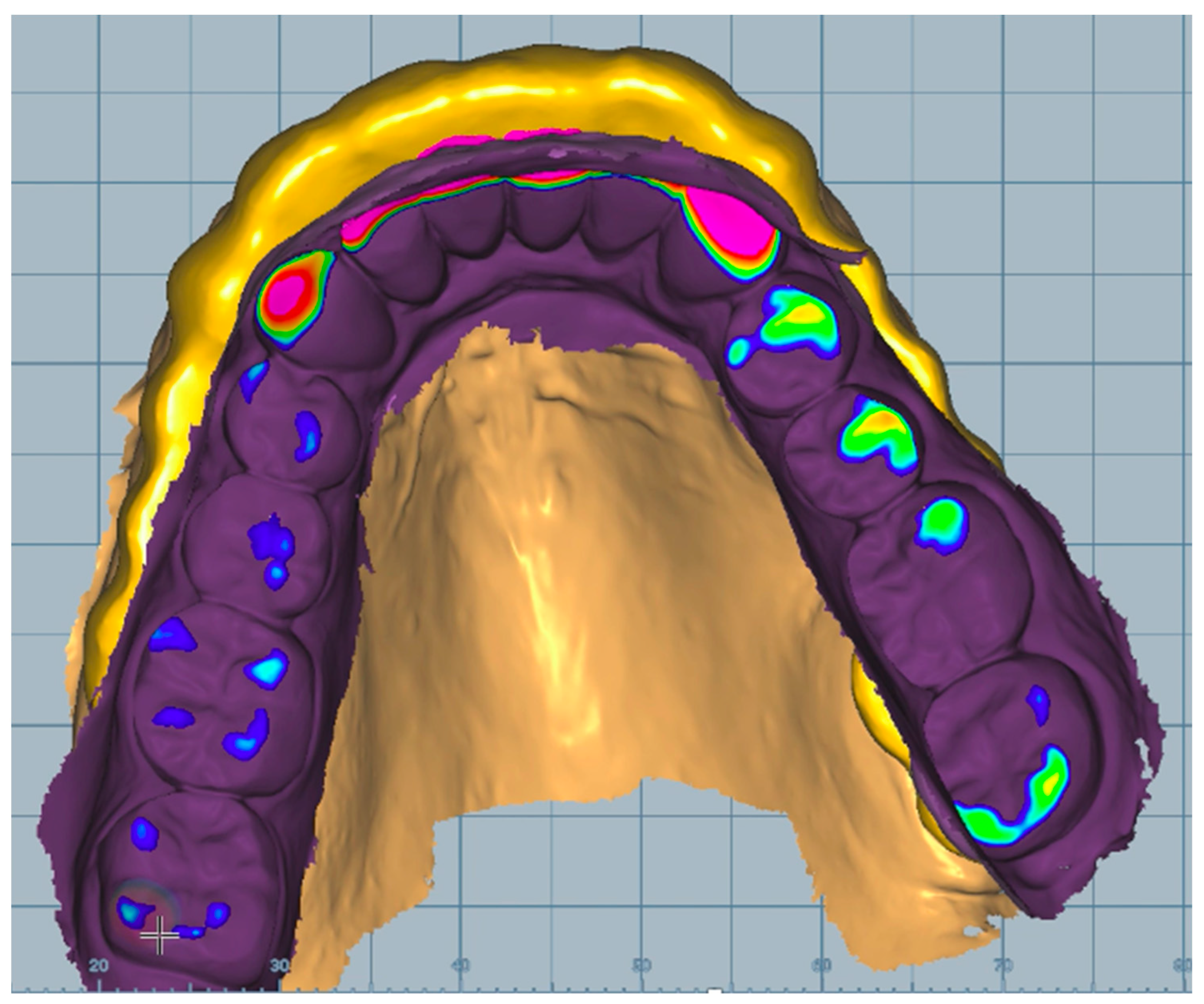 Dentistry 11 00126 g004