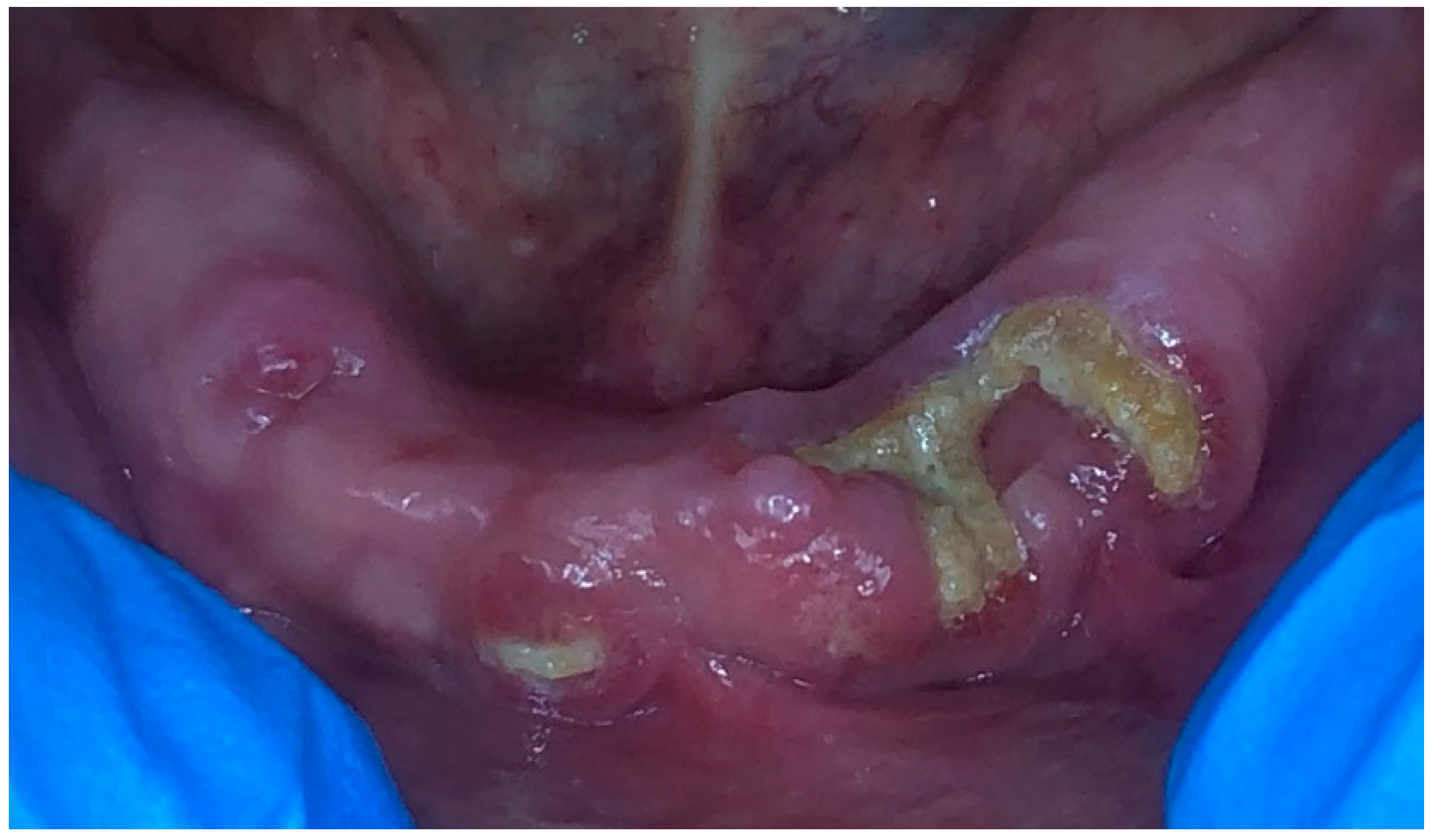 Dentistry 11 00127 g001 Dentistry 11 00127 g001