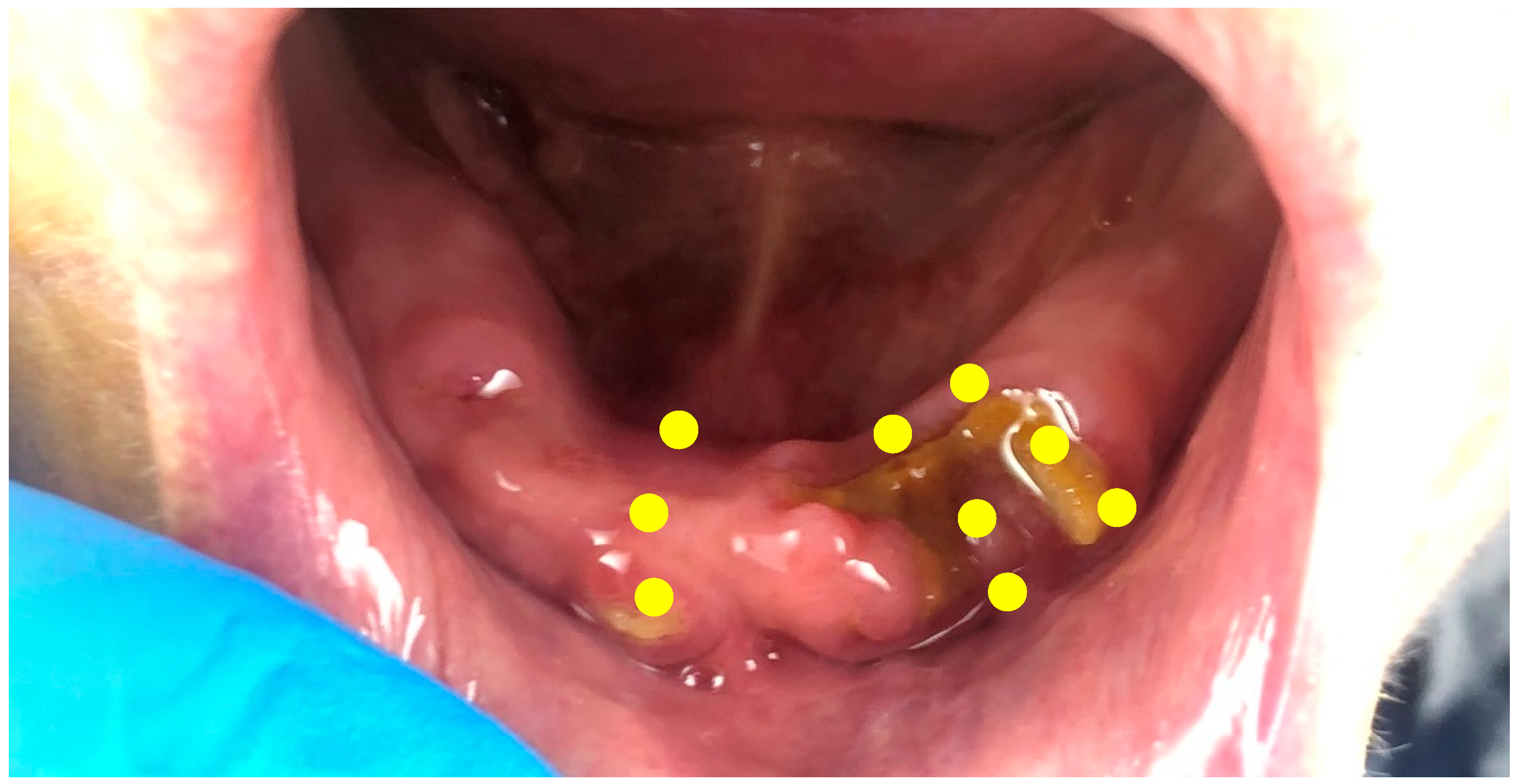 Dentistry 11 00127 g002 Dentistry 11 00127 g002