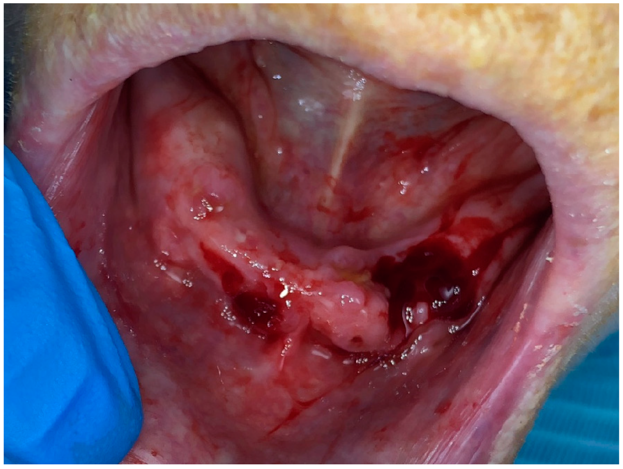 Dentistry 11 00127 g003 Dentistry 11 00127 g003