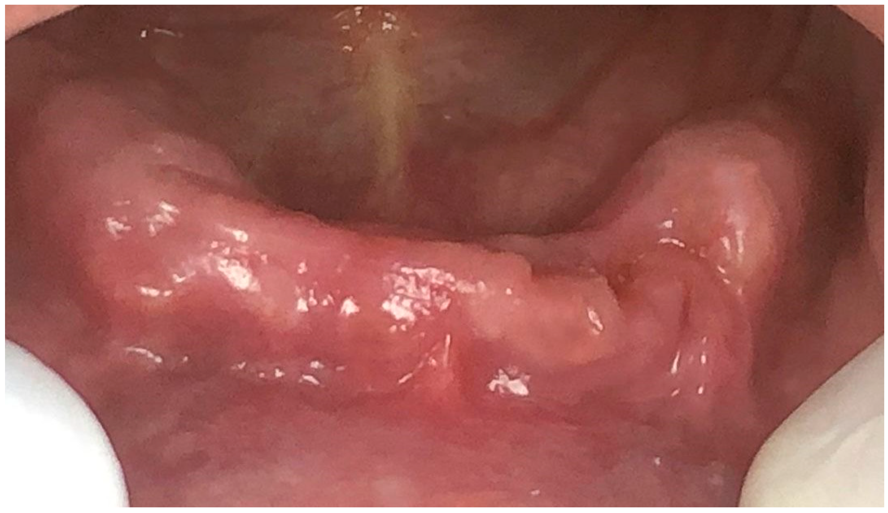 Dentistry 11 00127 g004 Dentistry 11 00127 g004