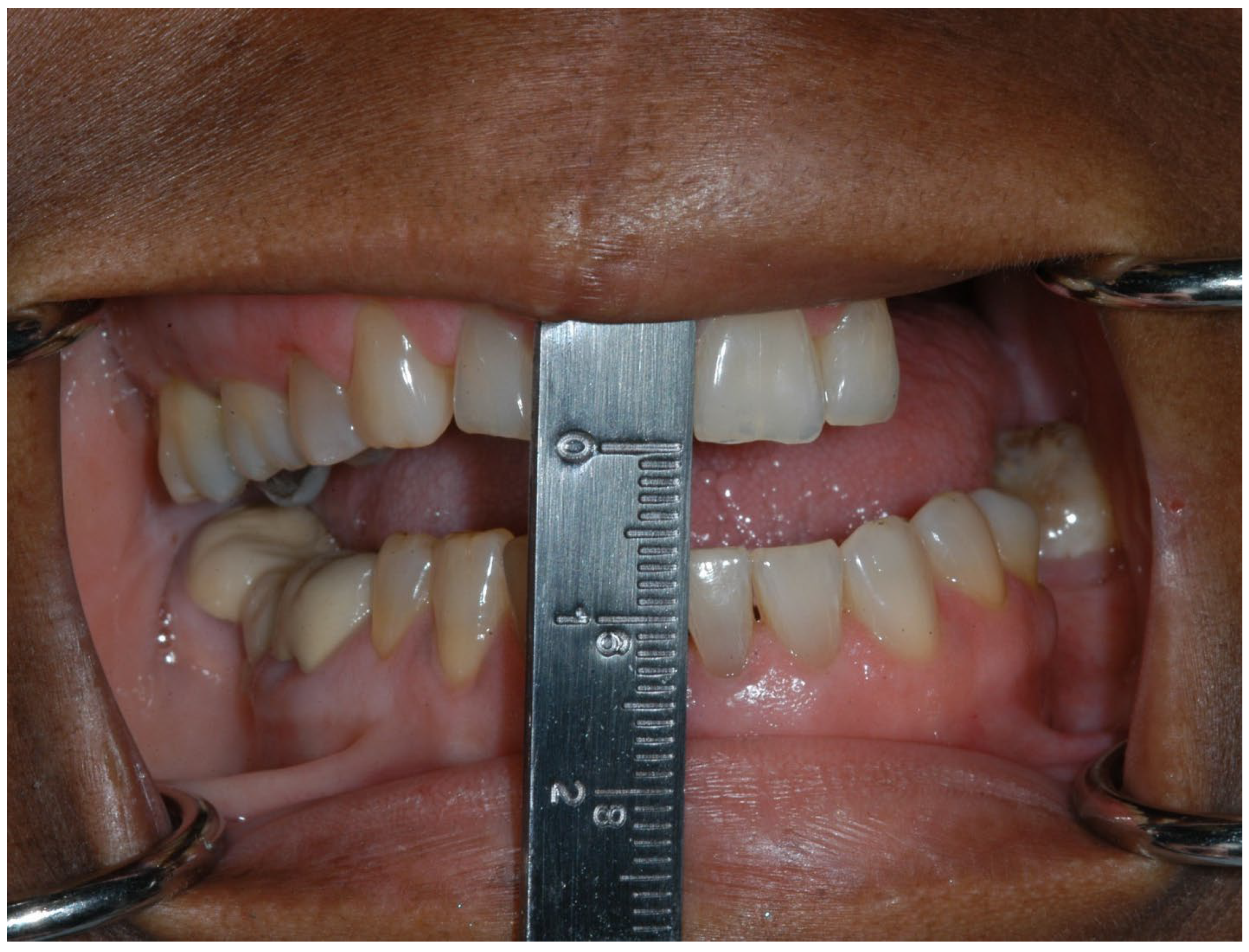 Dentistry 11 00136 g006