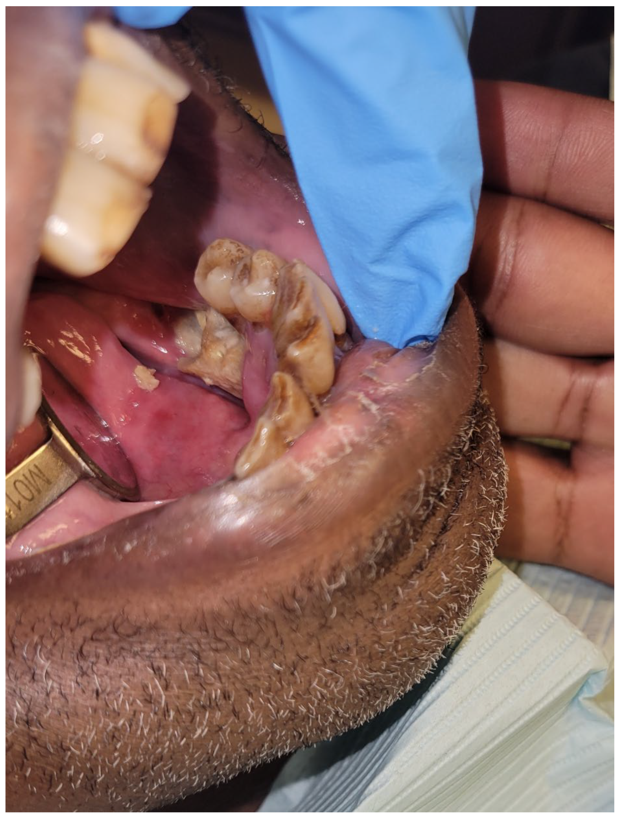 Dentistry 11 00136 g007