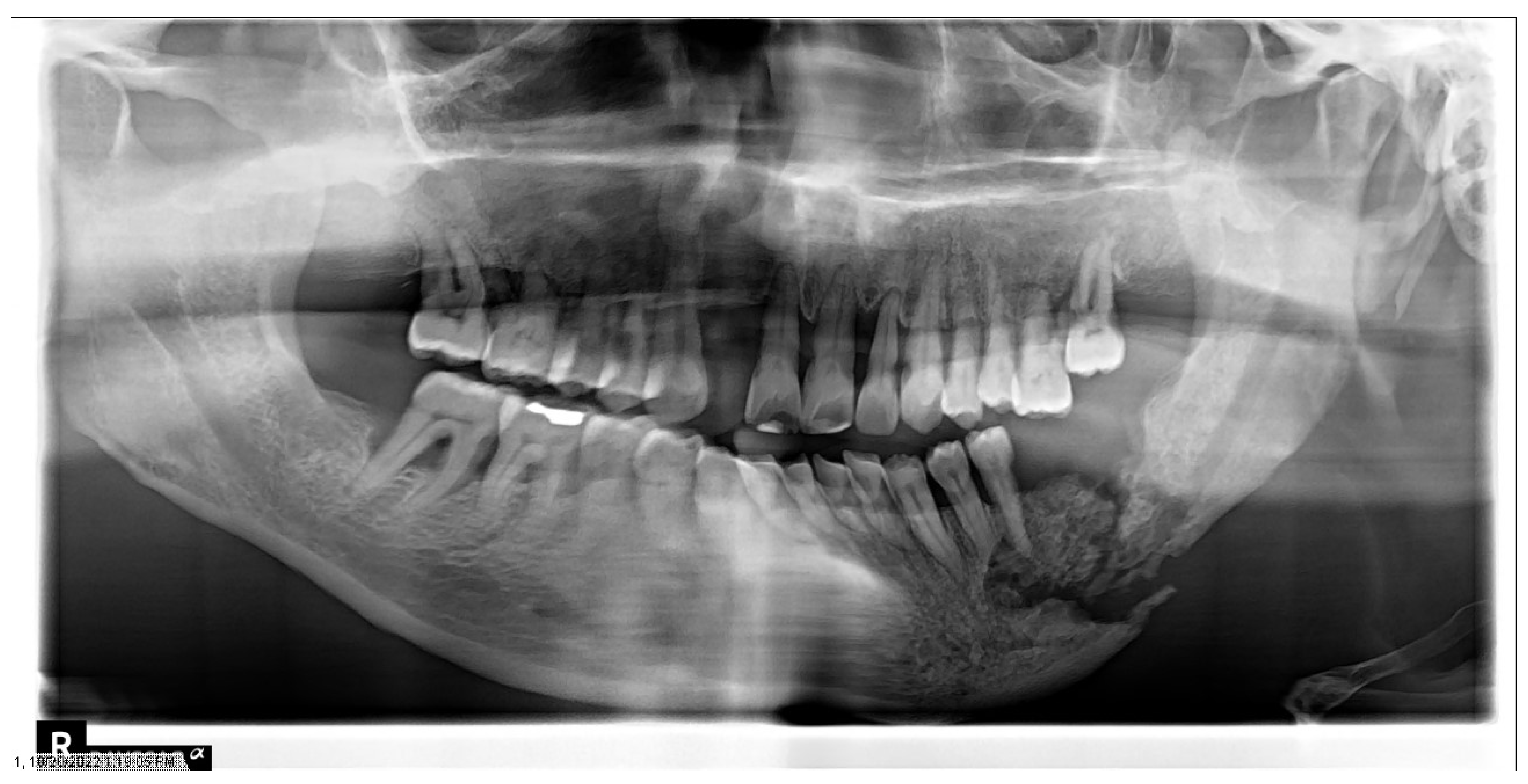 Dentistry 11 00136 g008