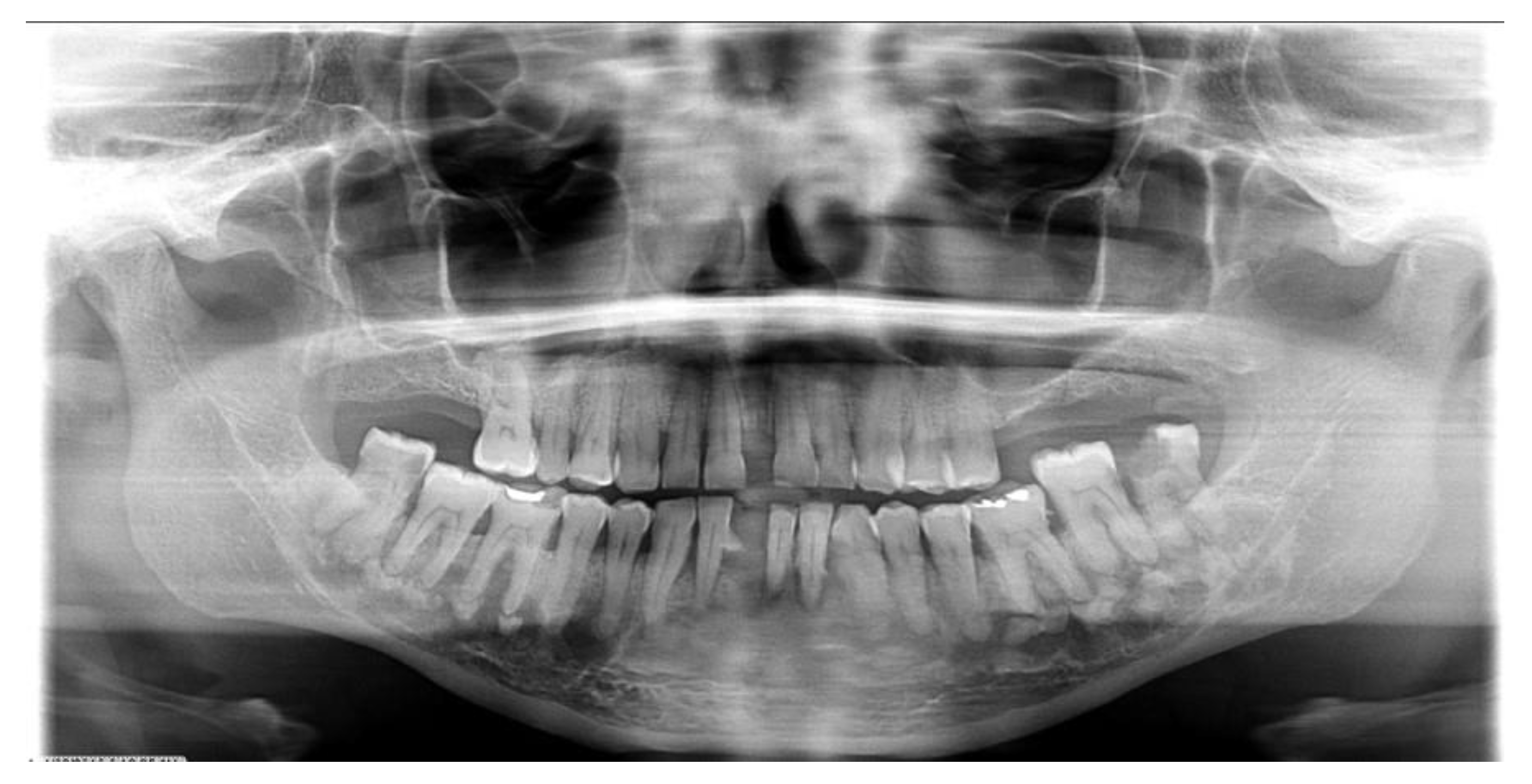 Dentistry 11 00138 g002 Dentistry 11 00138 g002