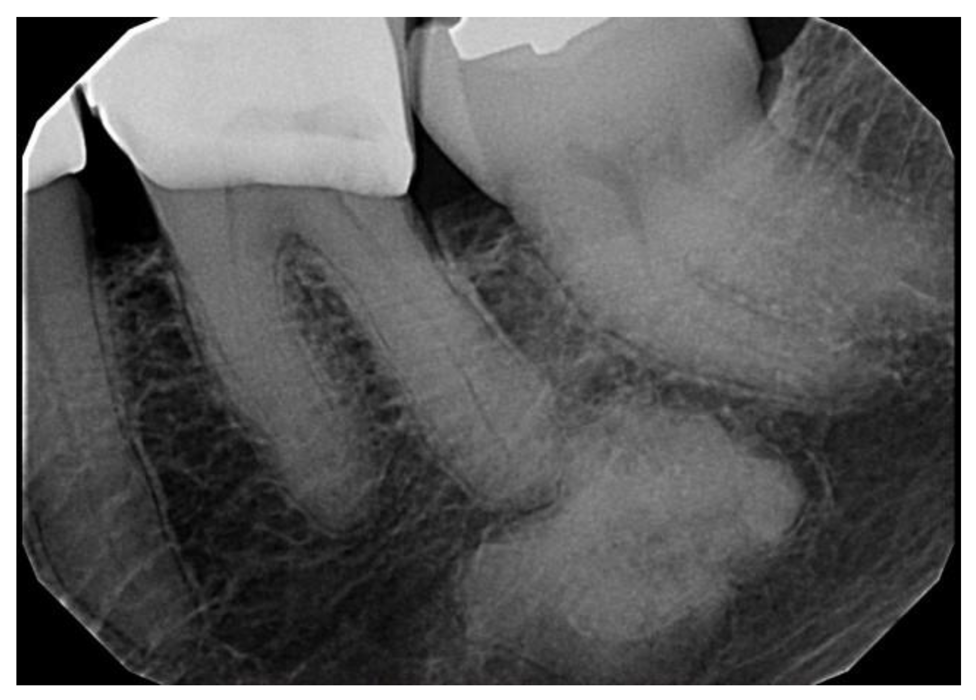 Dentistry 11 00138 g005 Dentistry 11 00138 g005