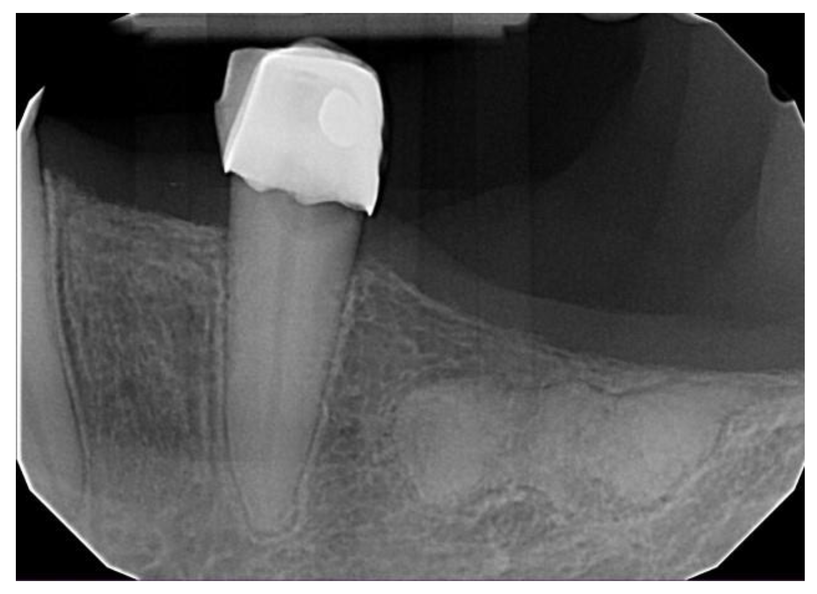 Dentistry 11 00138 g006 Dentistry 11 00138 g006