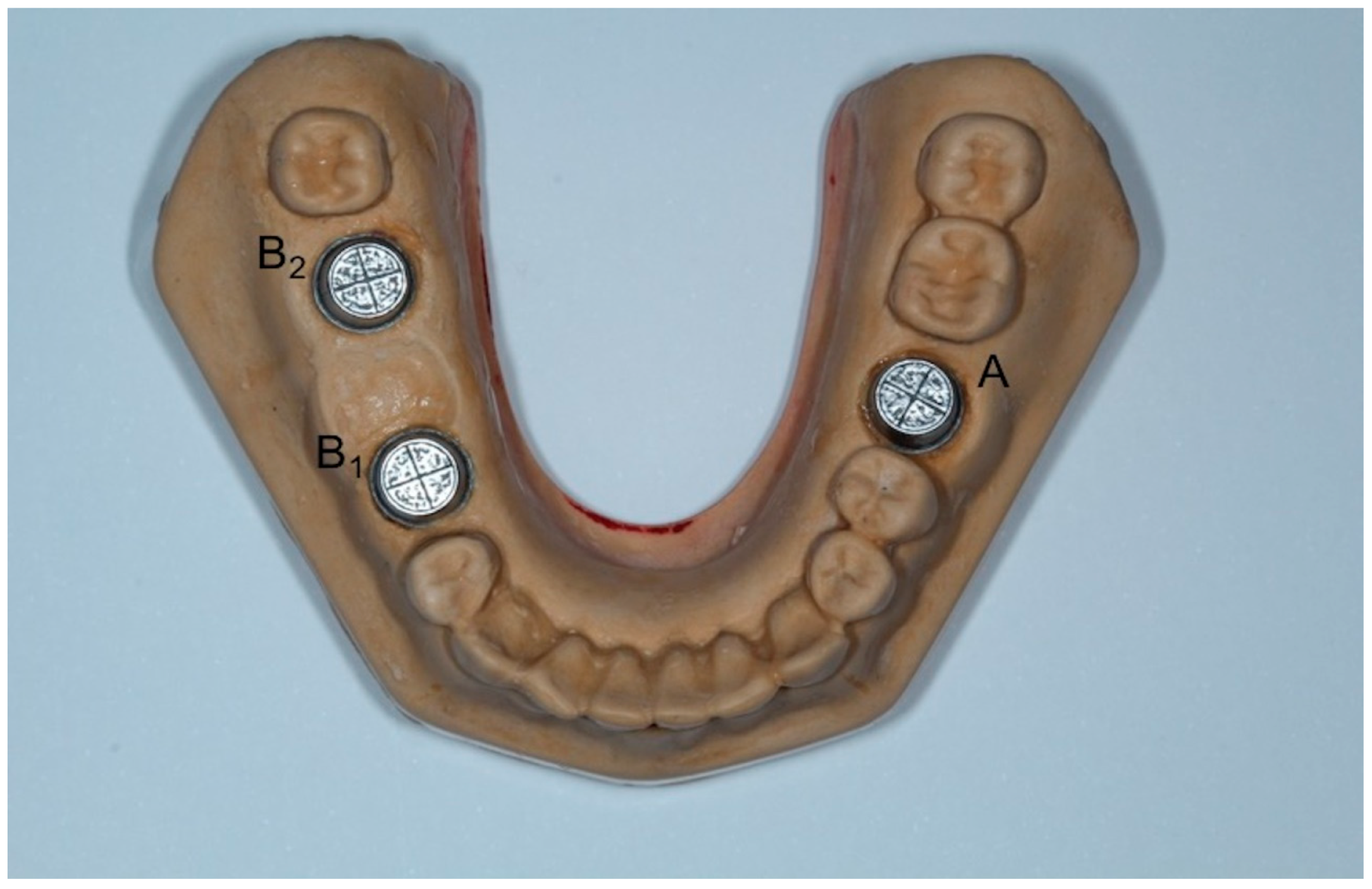 Dentistry Journal Free FullText Is a WigglingMotion Modified Two