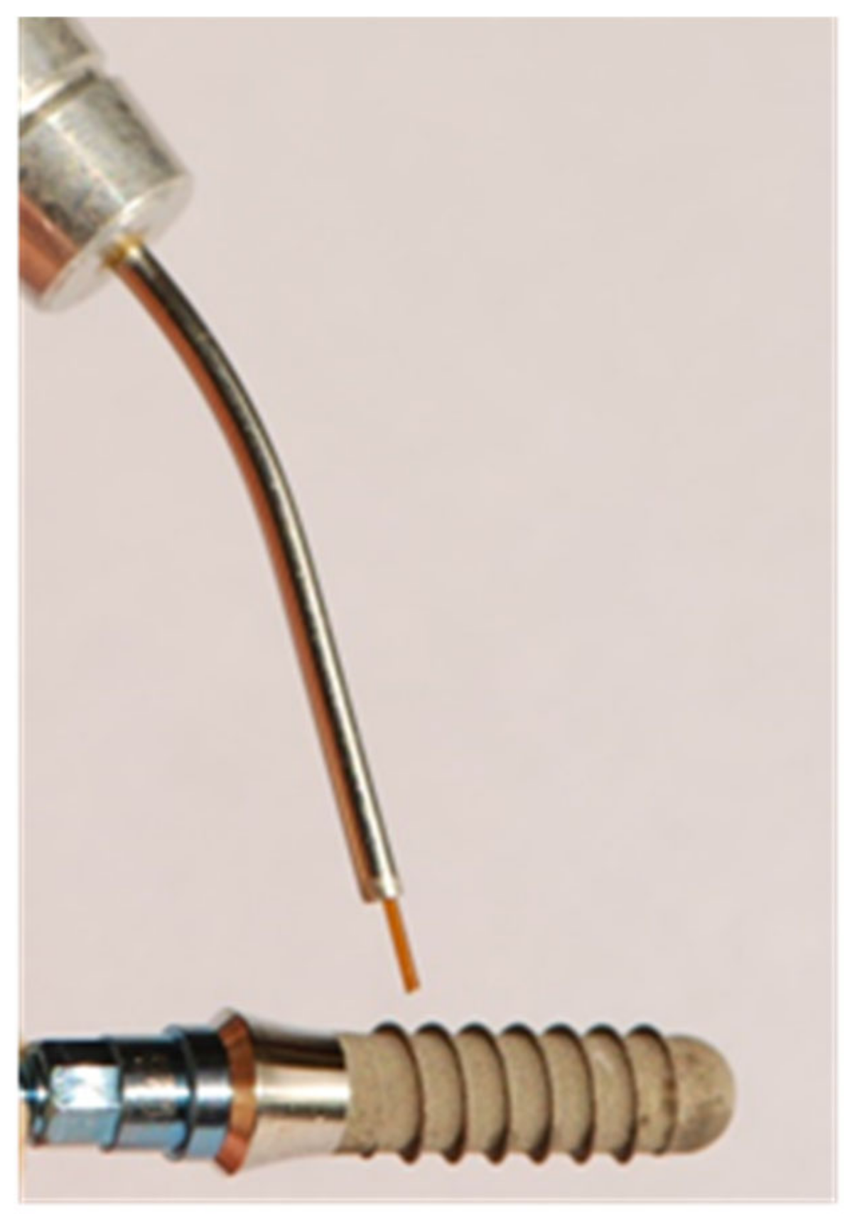 Dentistry 11 00148 g001