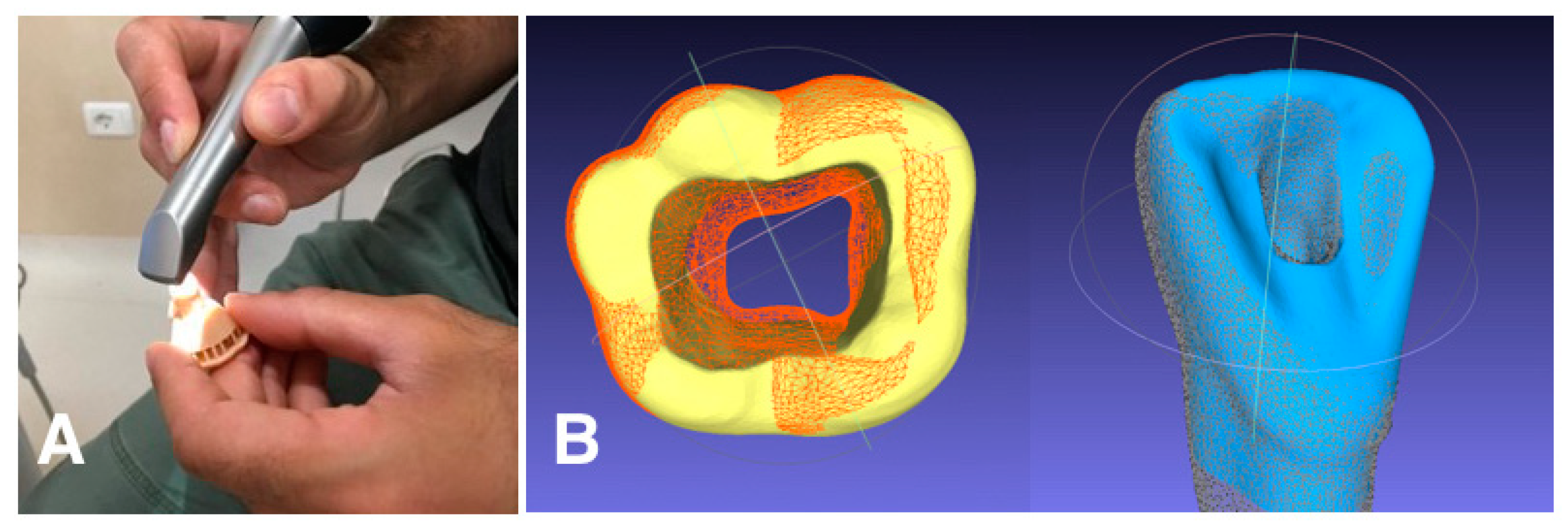 Dentistry 11 00152 g004