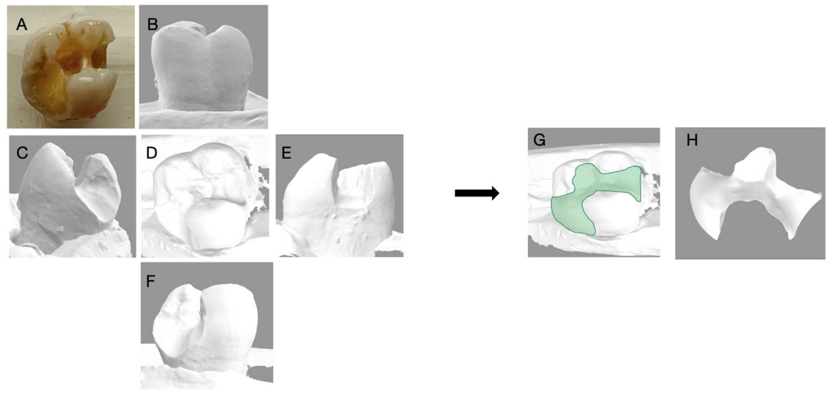 Dentistry 11 00159 g006