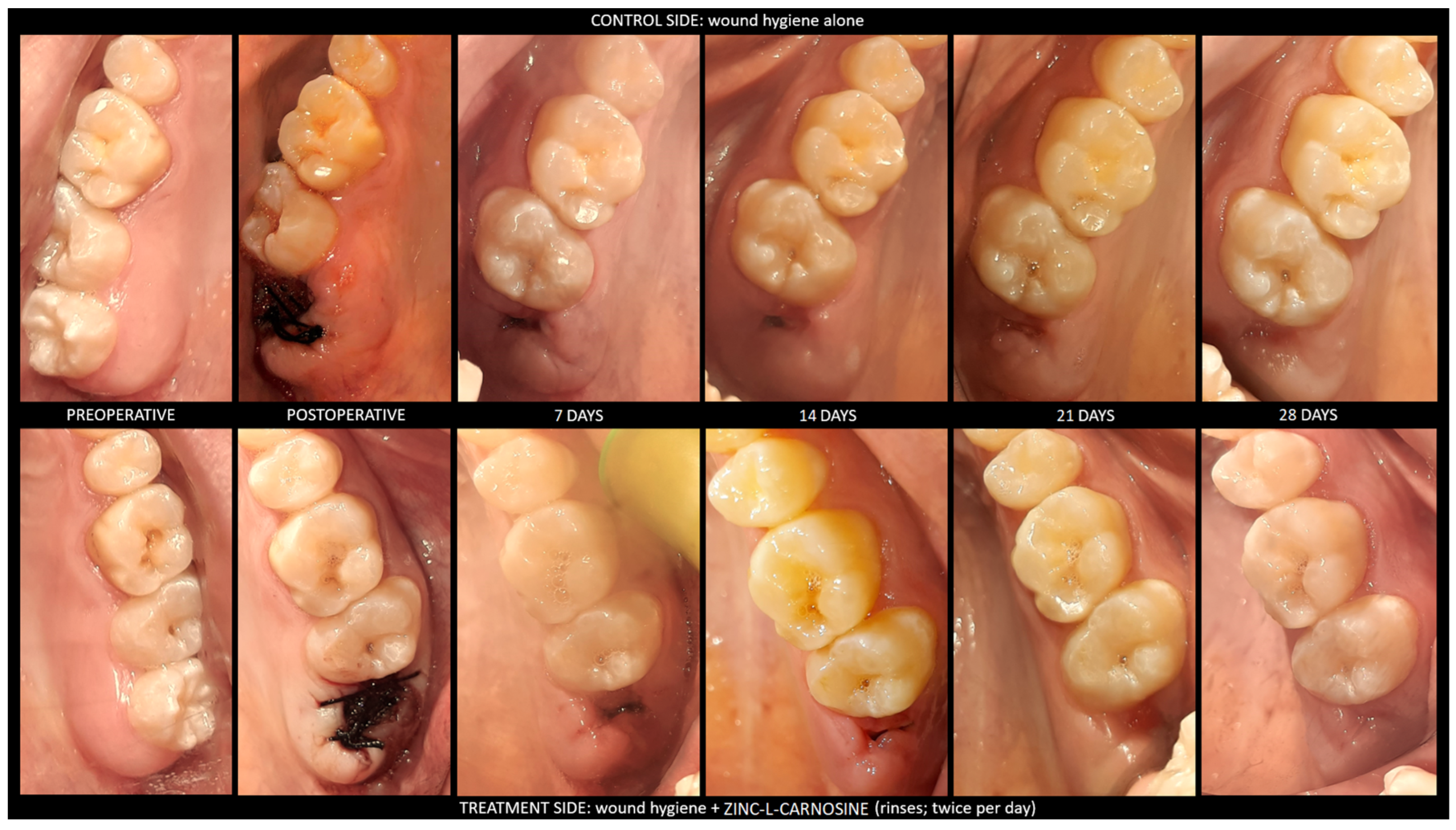 Dentistry 11 00181 g001