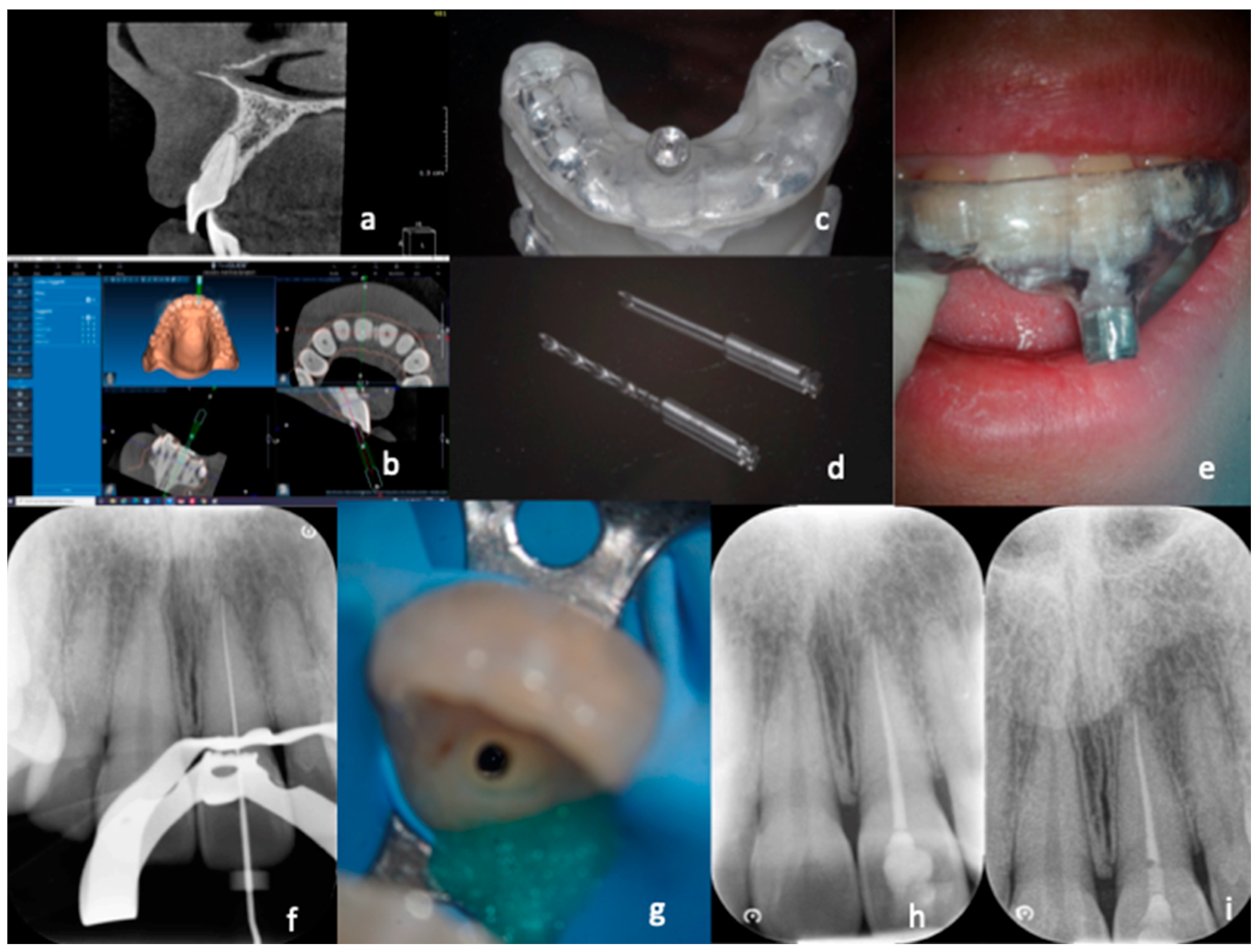 Dentistry 11 00183 g001