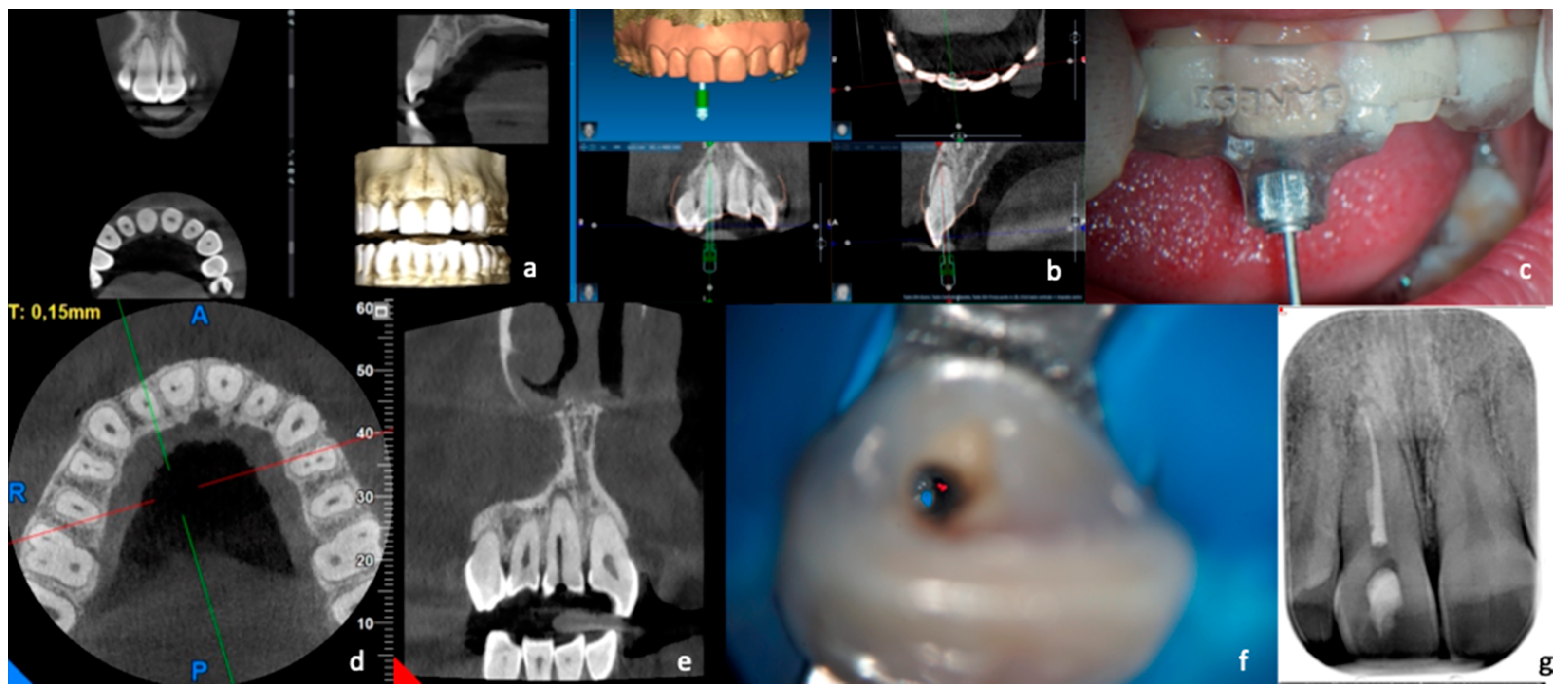 Dentistry 11 00183 g002