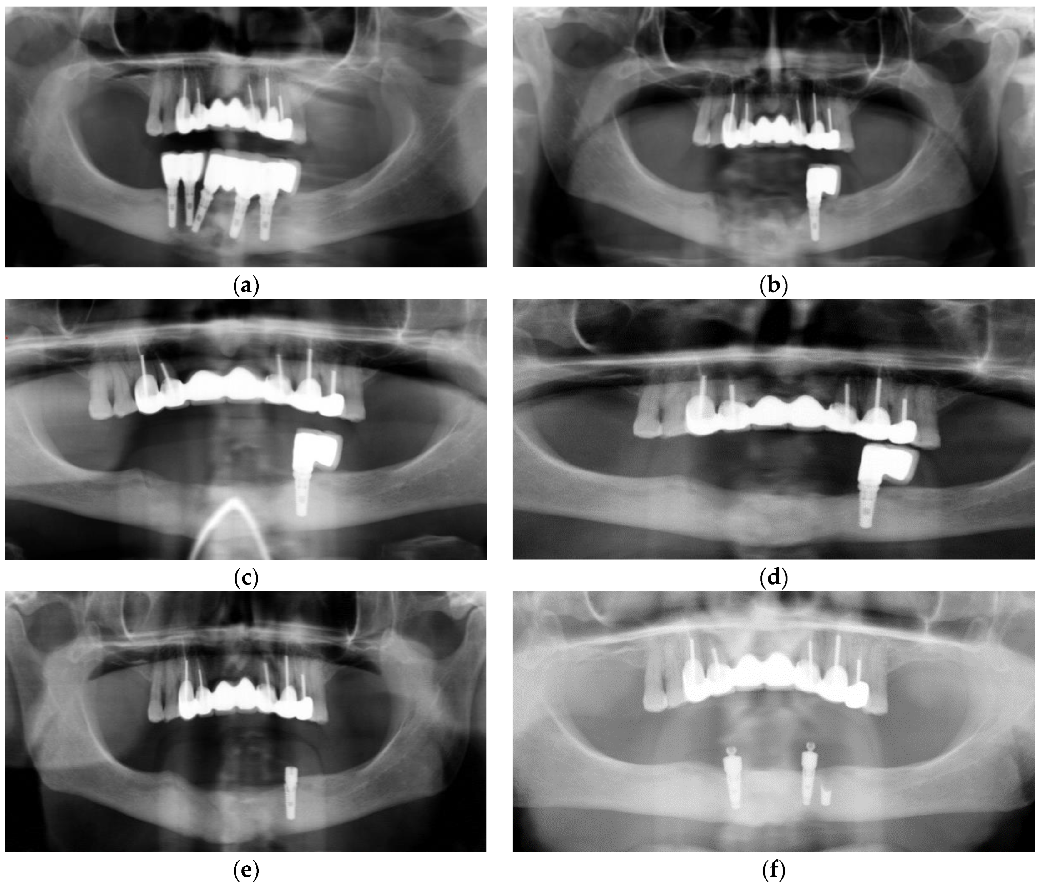 Dentistry 11 00184 g001 Dentistry 11 00184 g001