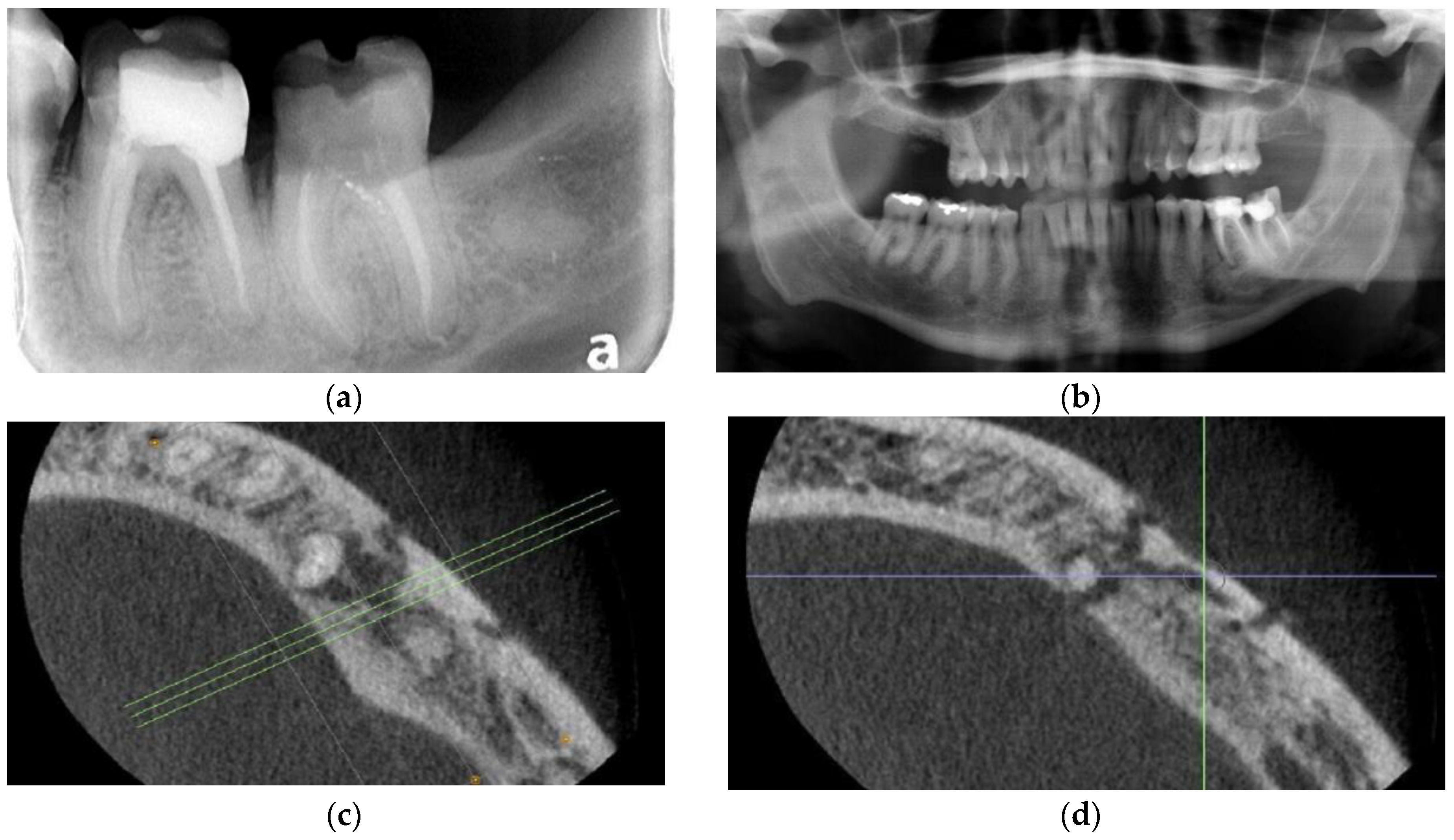 Dentistry 11 00184 g002a Dentistry 11 00184 g002a