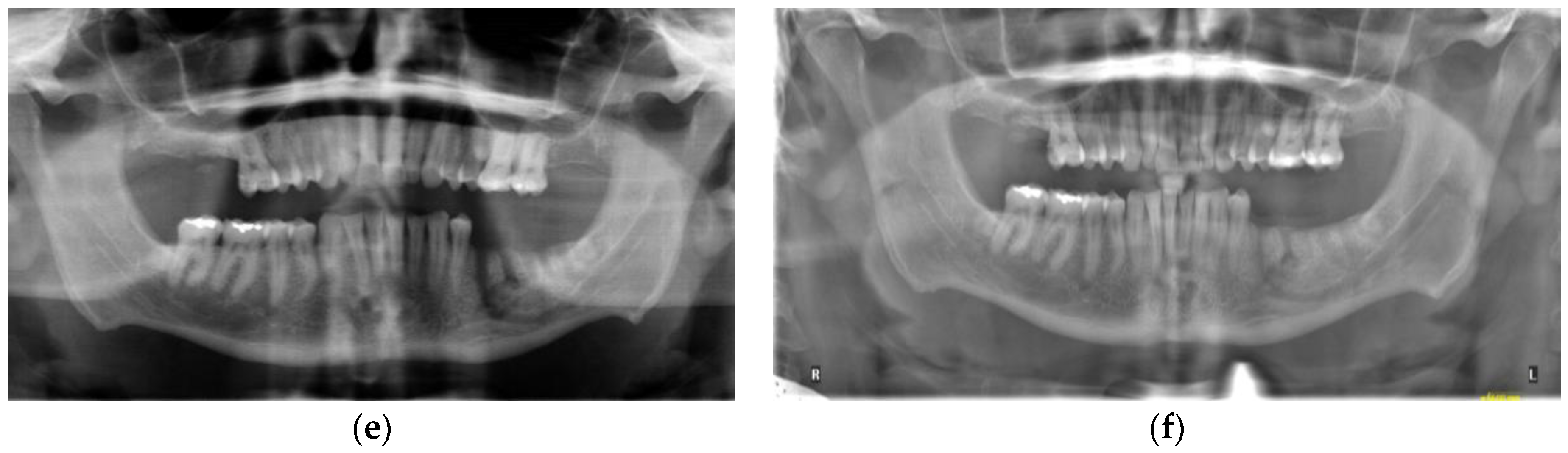 Dentistry 11 00184 g002b Dentistry 11 00184 g002b