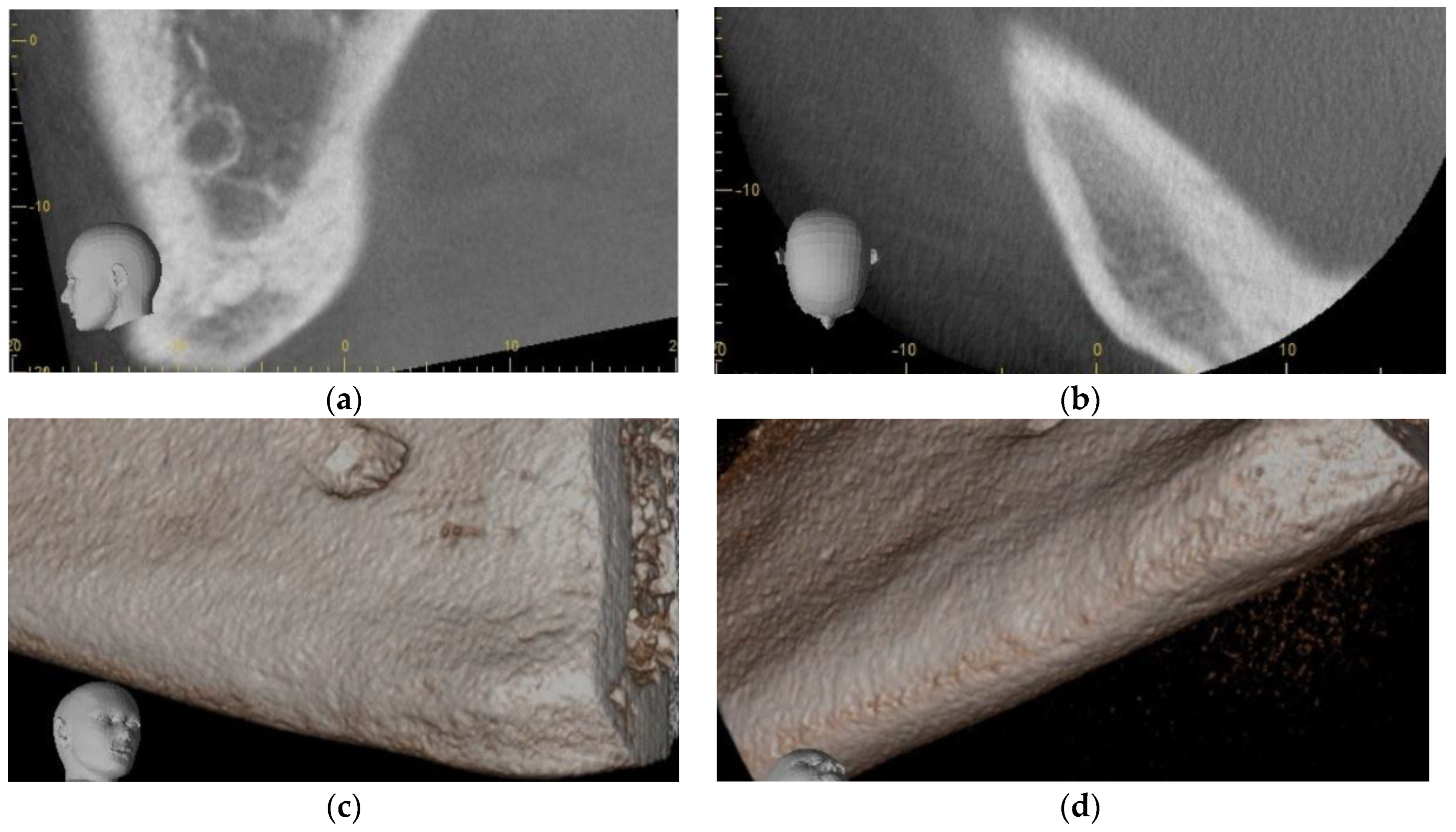 Dentistry 11 00184 g006 Dentistry 11 00184 g006