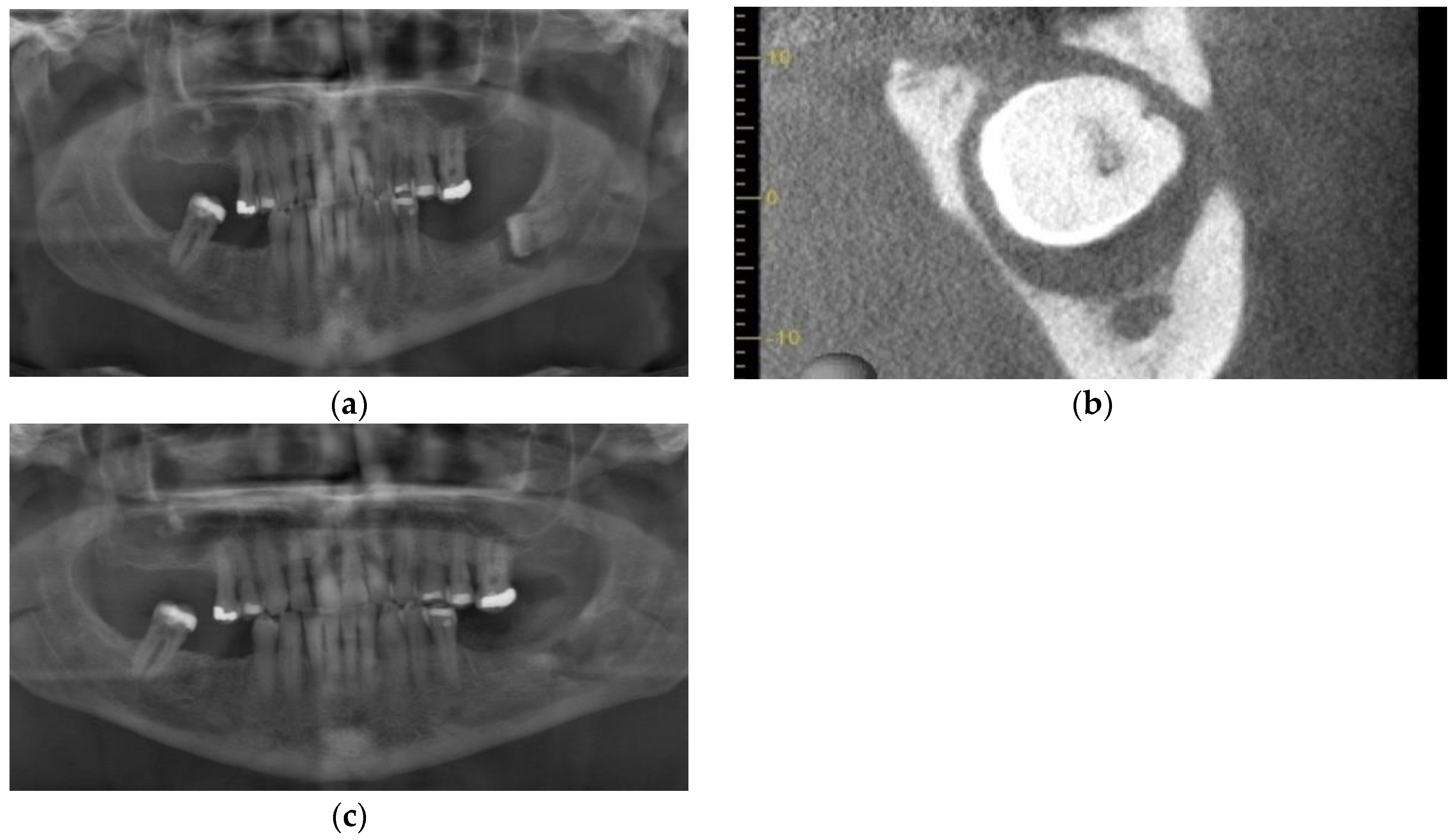 Dentistry 11 00184 g007 Dentistry 11 00184 g007
