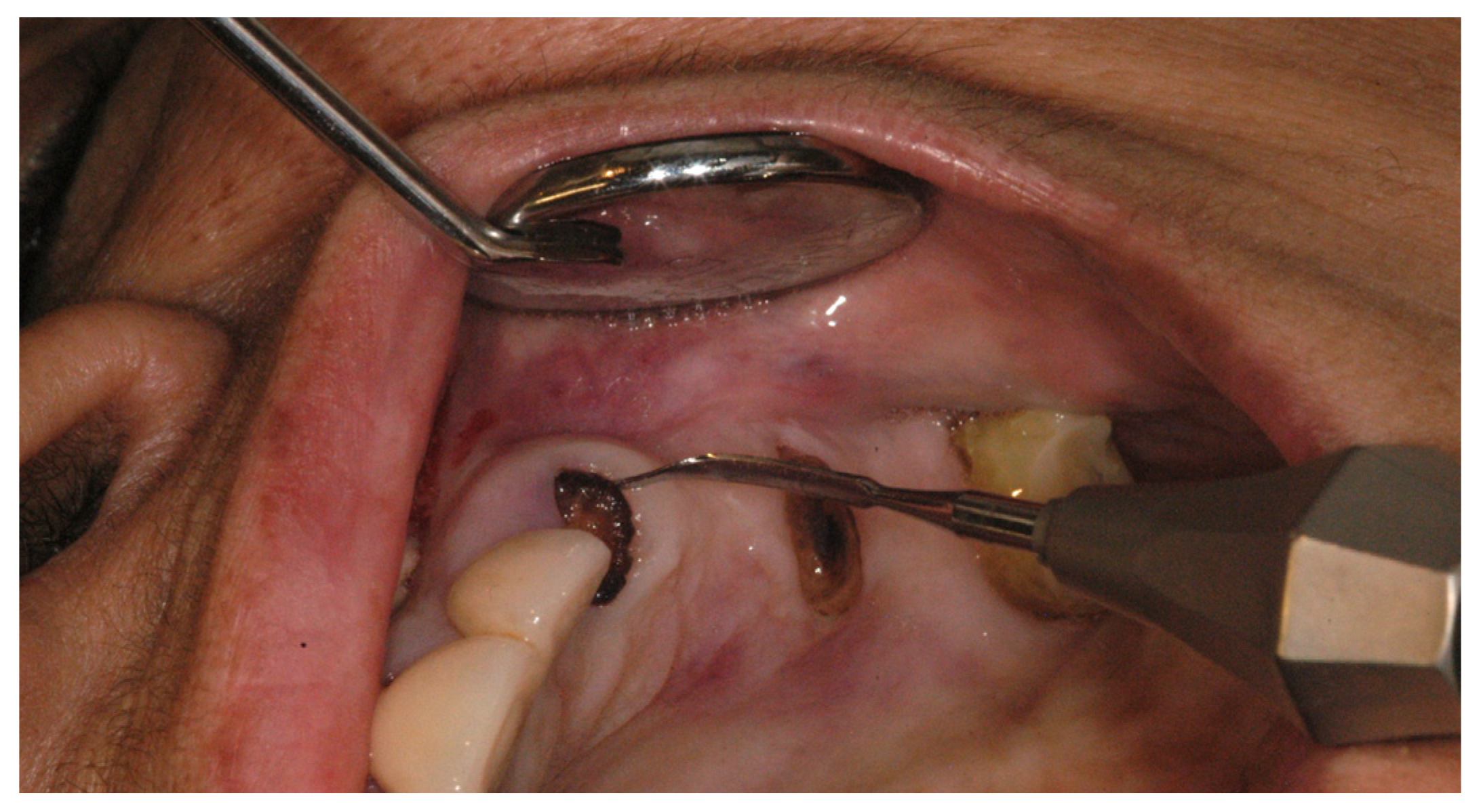 Dentistry 11 00196 g002