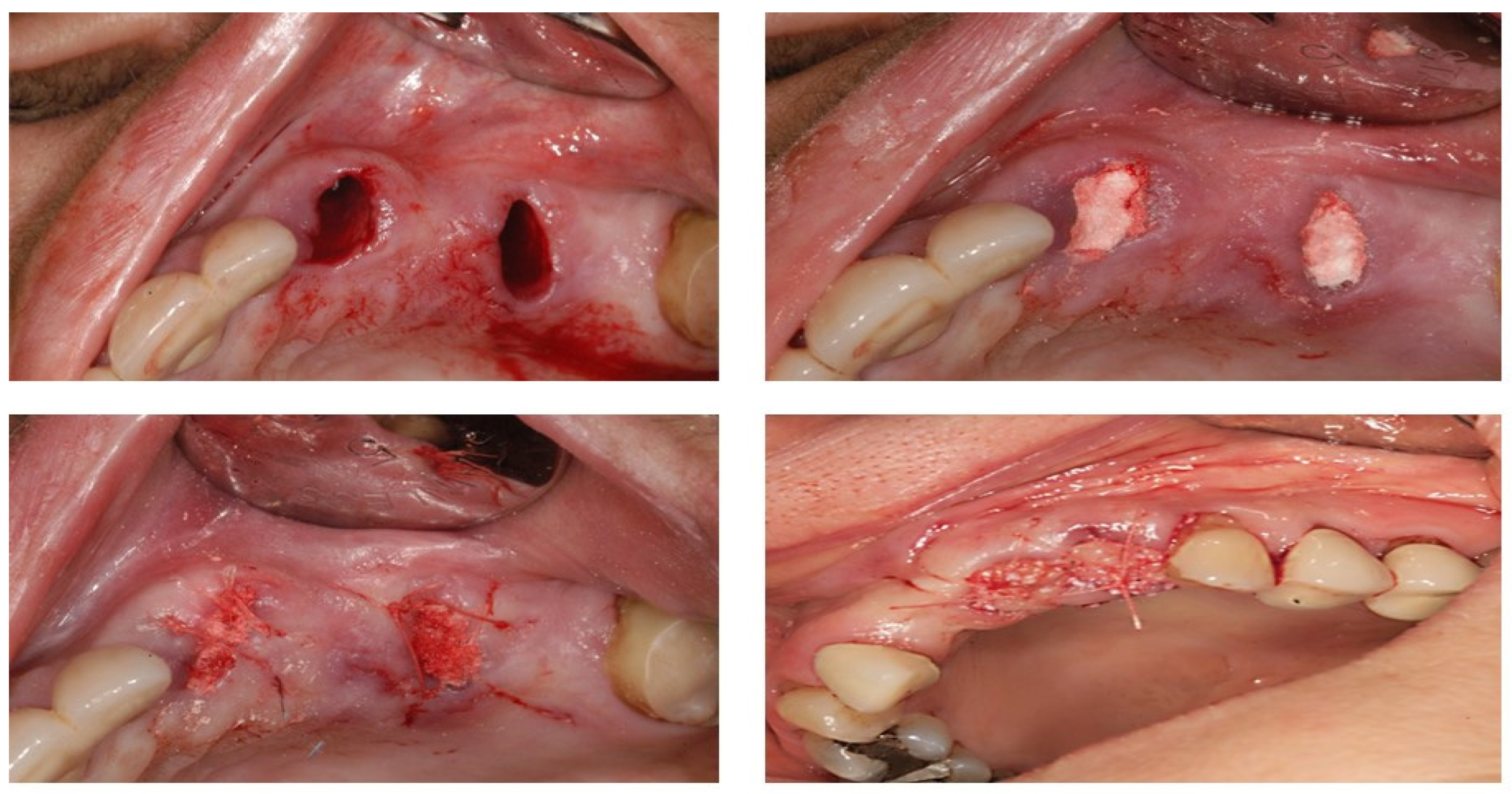Dentistry 11 00196 g003