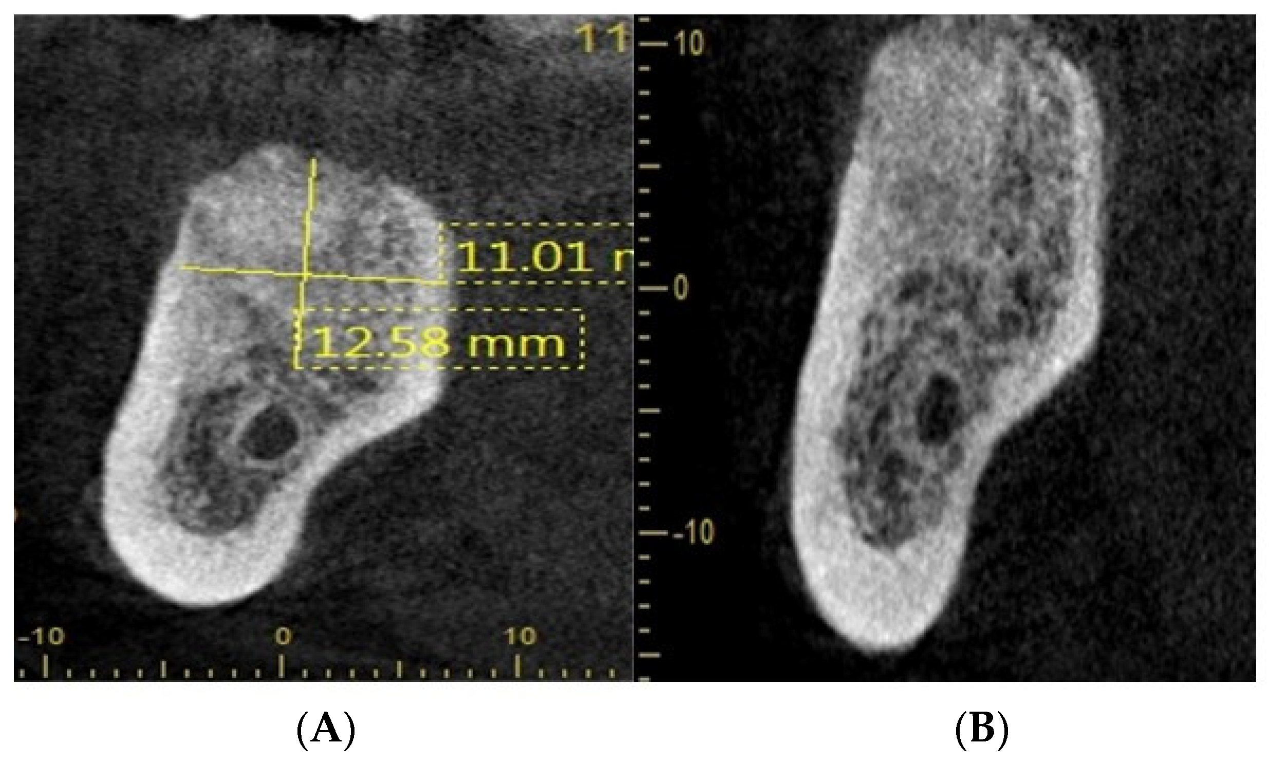 Dentistry 11 00196 g004