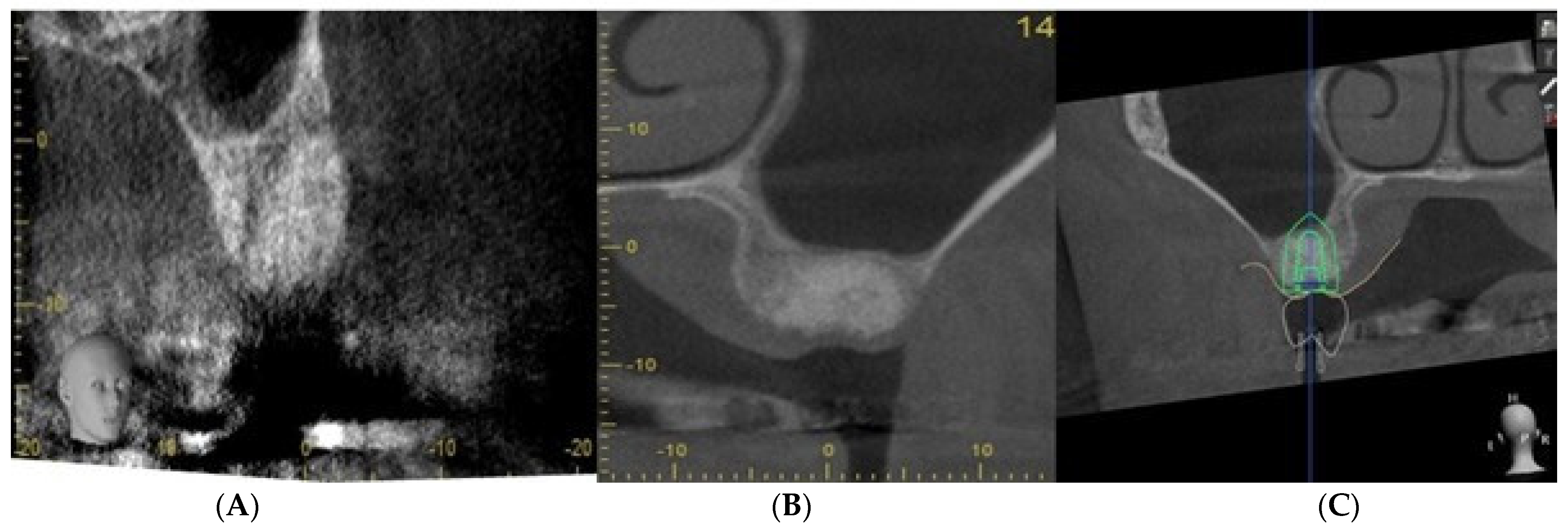 Dentistry 11 00196 g005