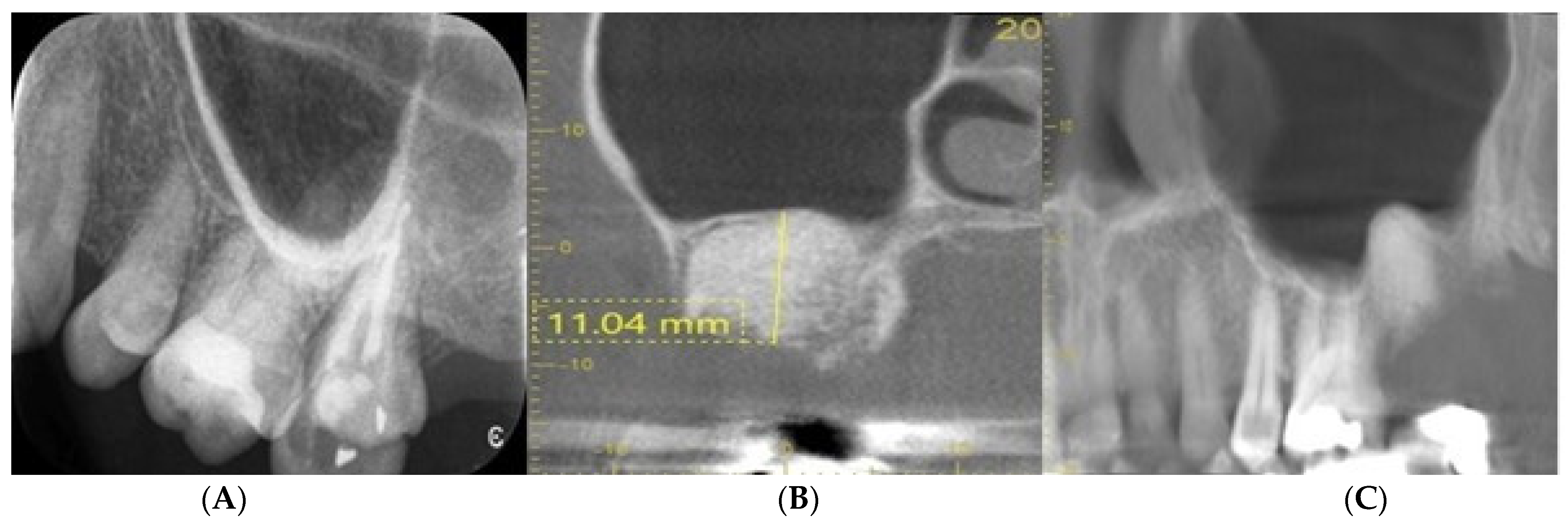 Dentistry 11 00196 g006
