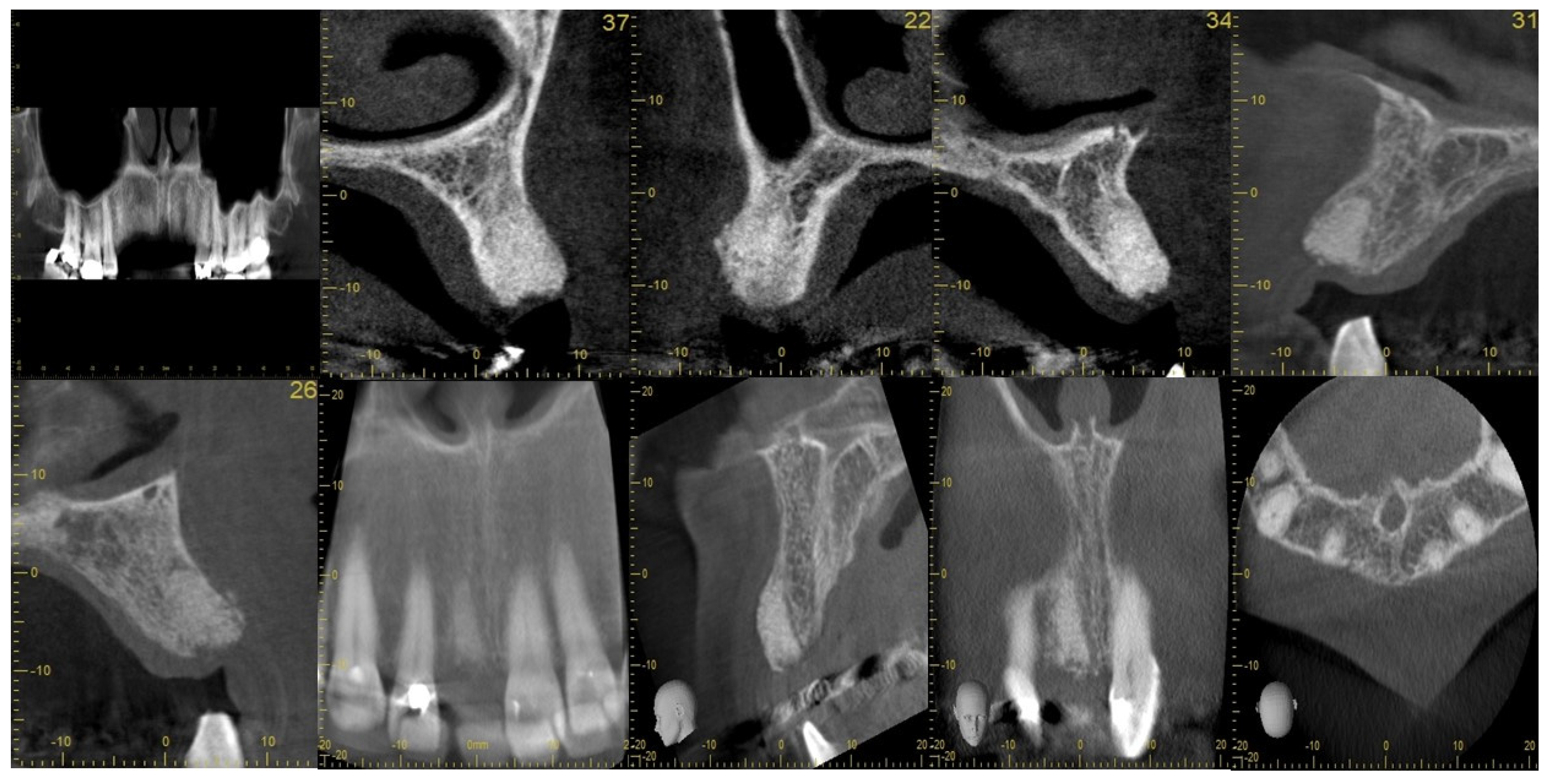Dentistry 11 00196 g007