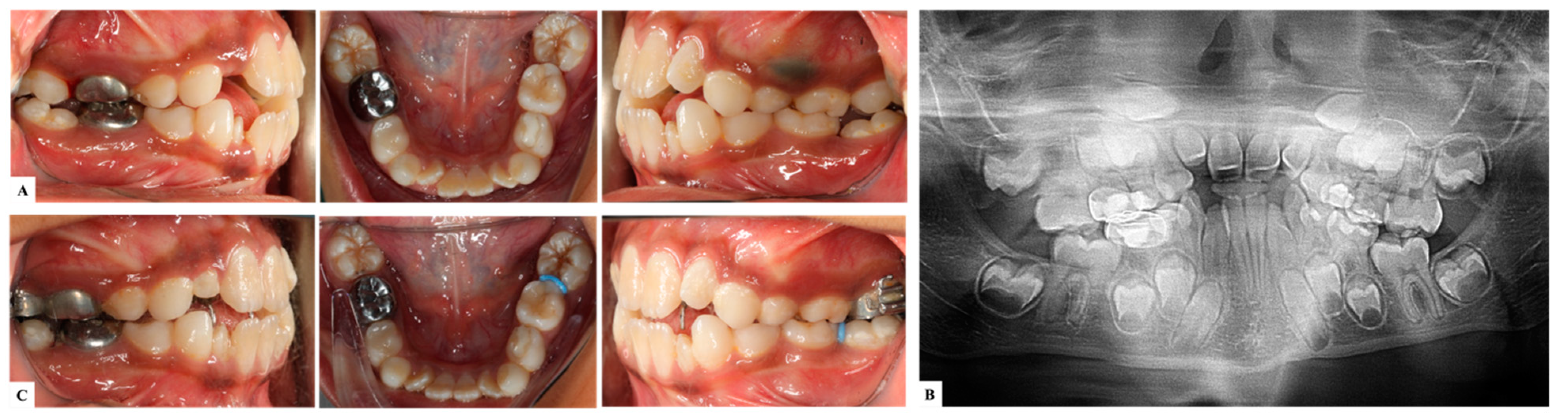 Dentistry 11 00206 g002