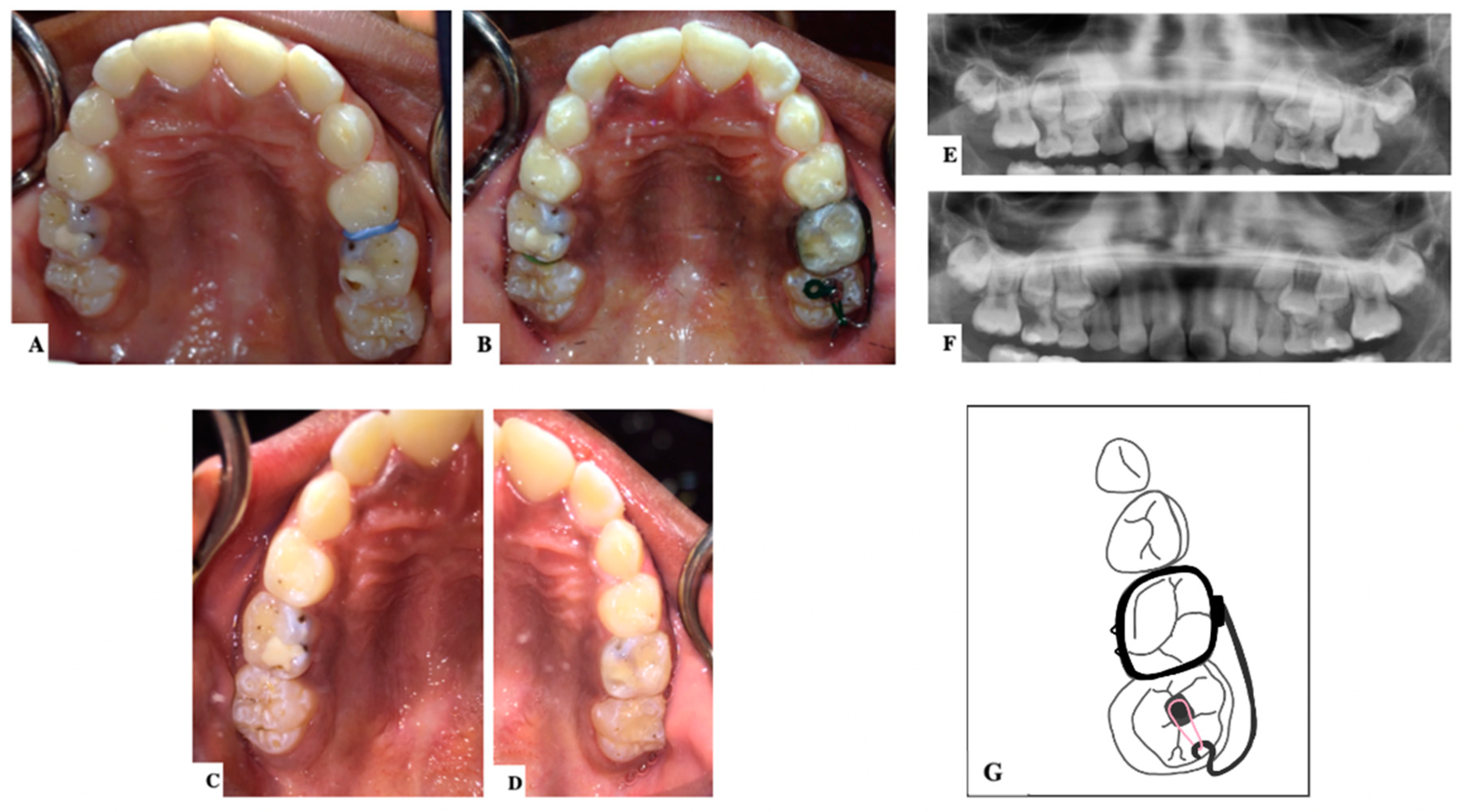 Dentistry 11 00206 g004