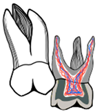 Dentistry 11 00206 i001