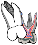 Dentistry 11 00206 i003