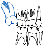 Dentistry 11 00206 i006