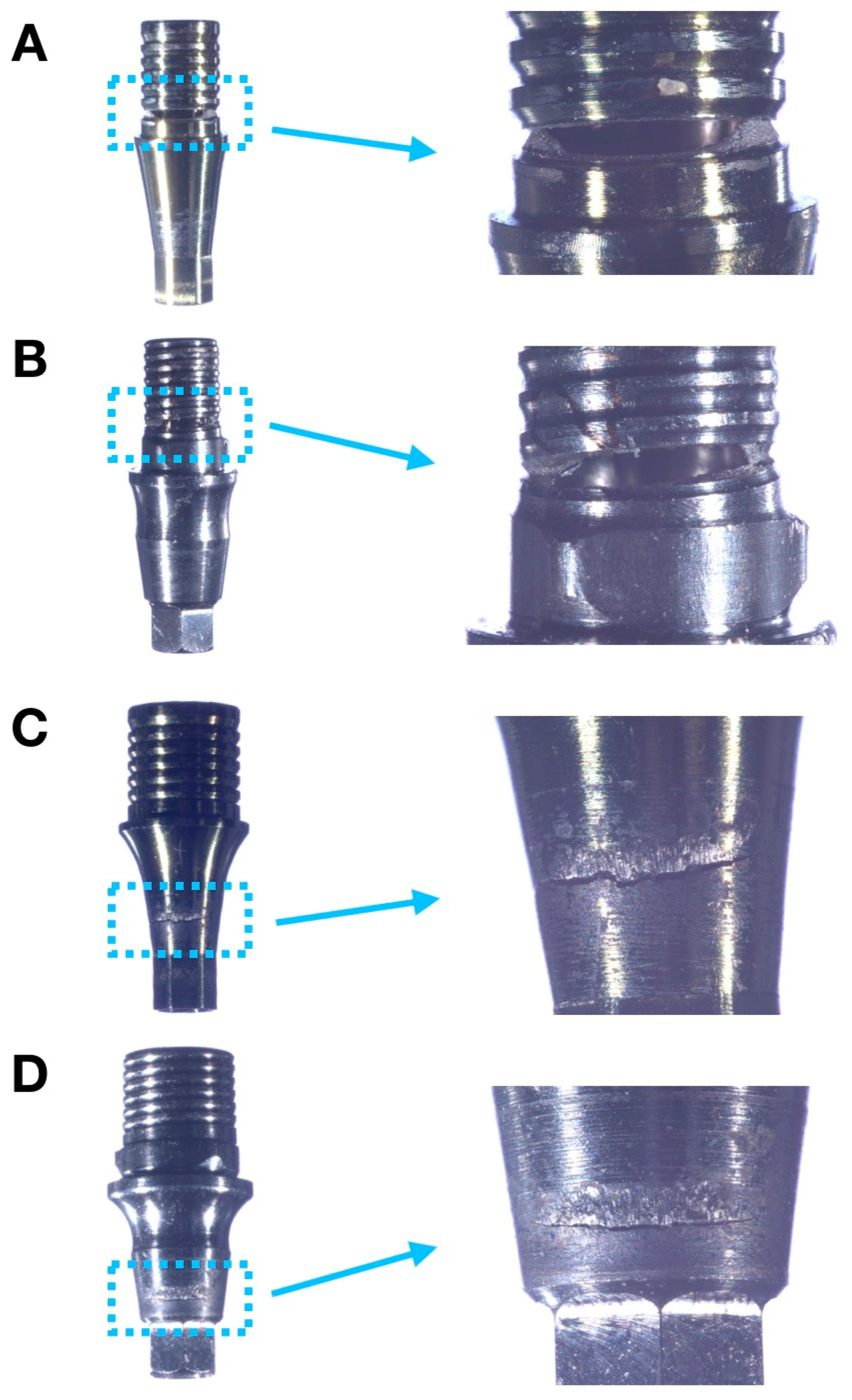 Dentistry 11 00207 g004